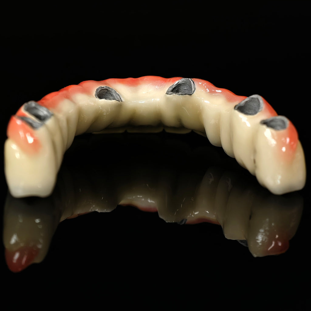 Co - Cr PFM Dental Bridge