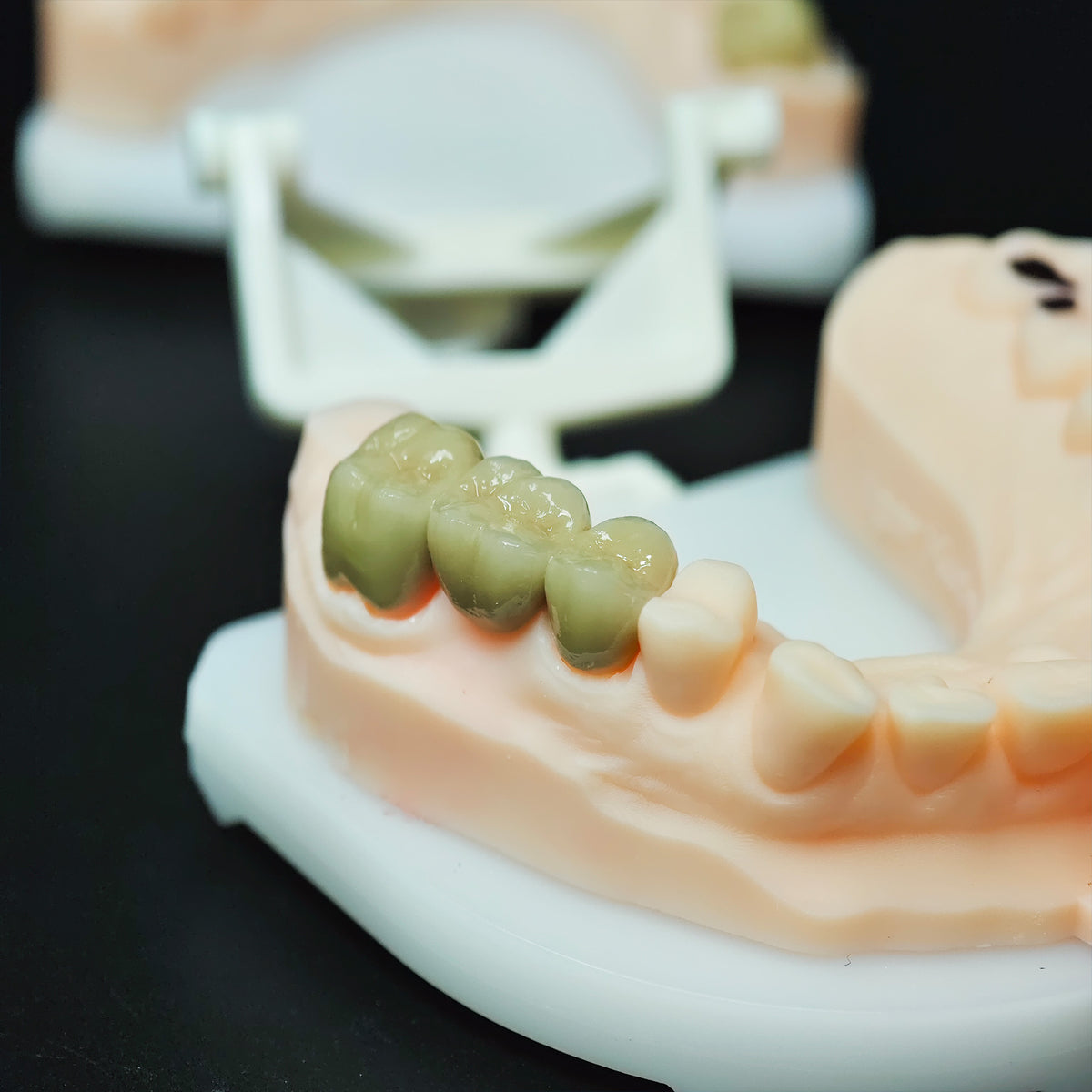 Co - Cr Pfm Dental Crowns And Bridge