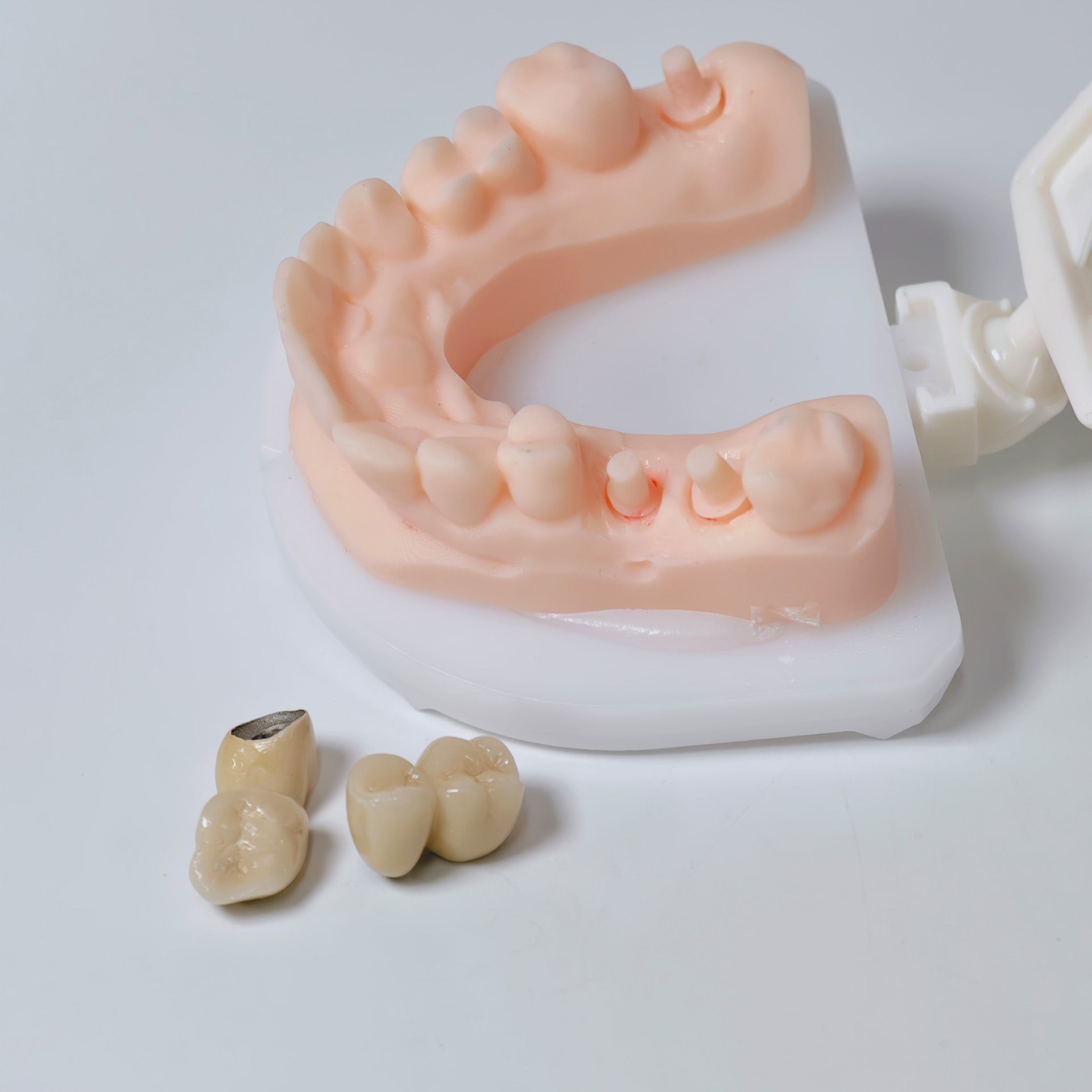 Co - Cr Pfm Dental Crowns And Bridge