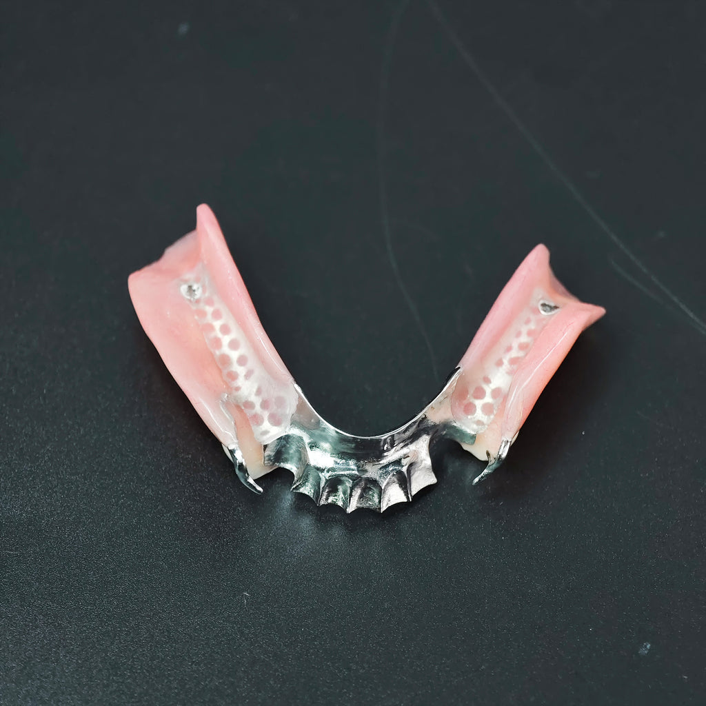 Cobalt Chrome Framework Denture Metal Framework With Acrylic Denture