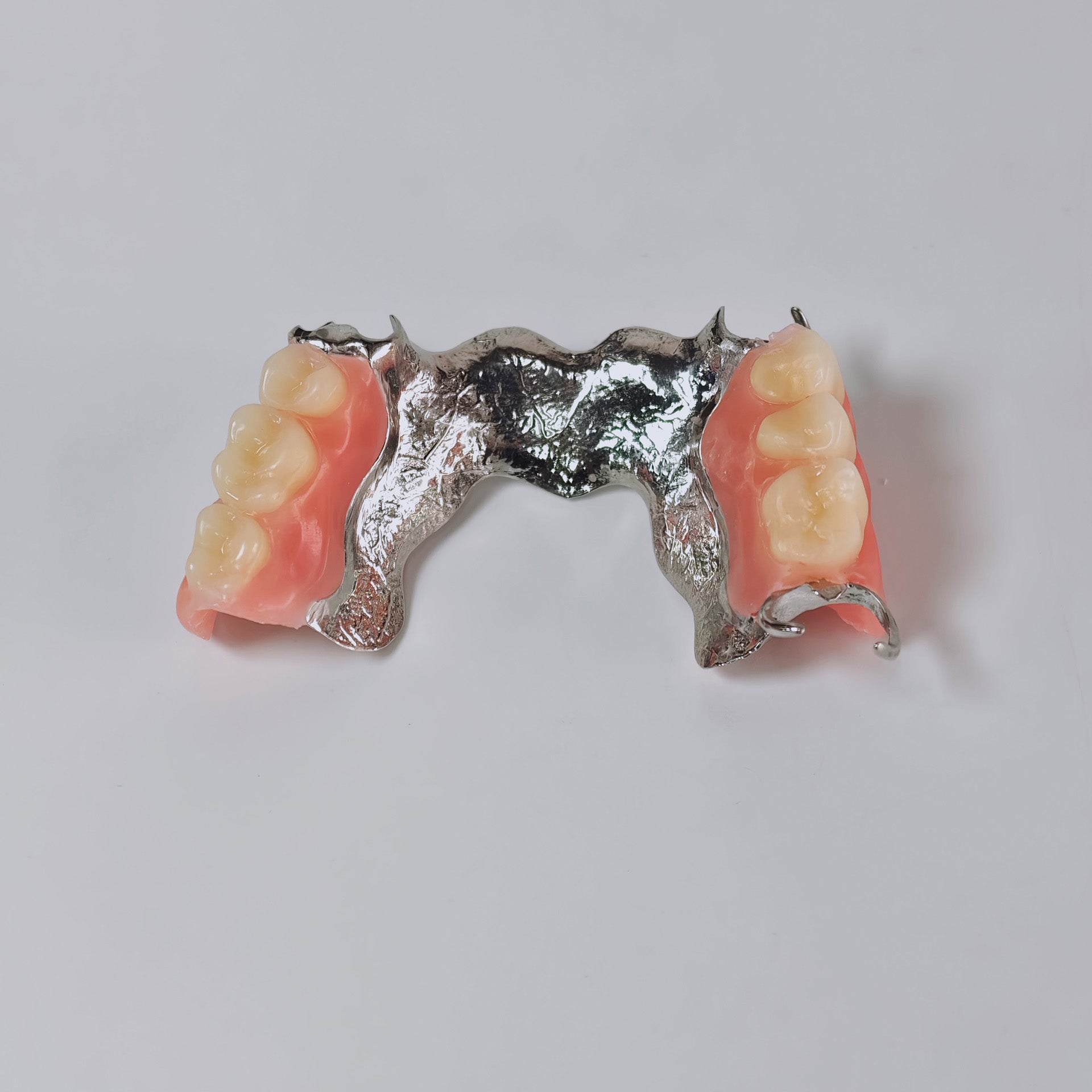 Cobalt Chrome Framework Denture Metal Framework With Acrylic Denture