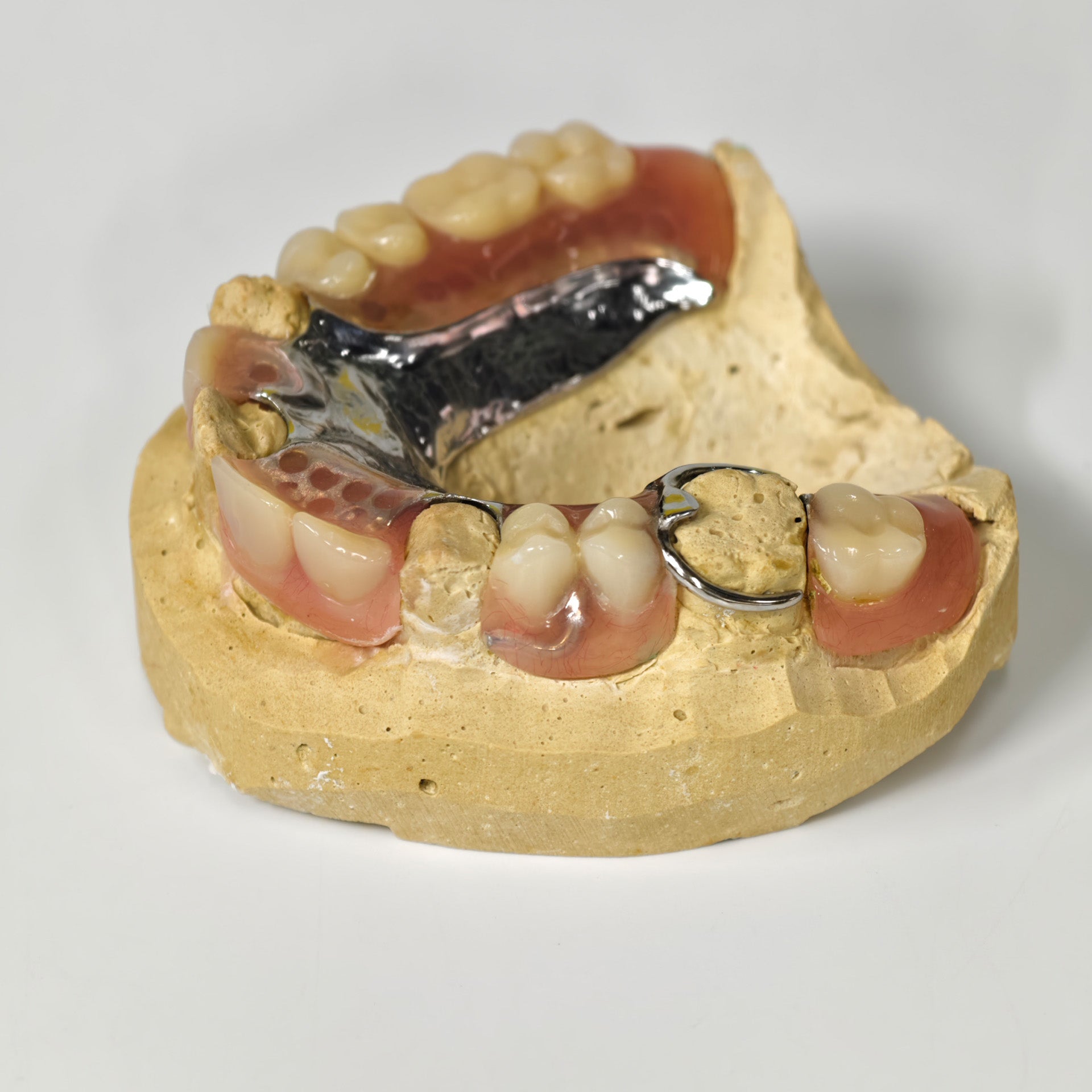 Cobalt Chrome Framework Denture Metal Framework With Acrylic Denture