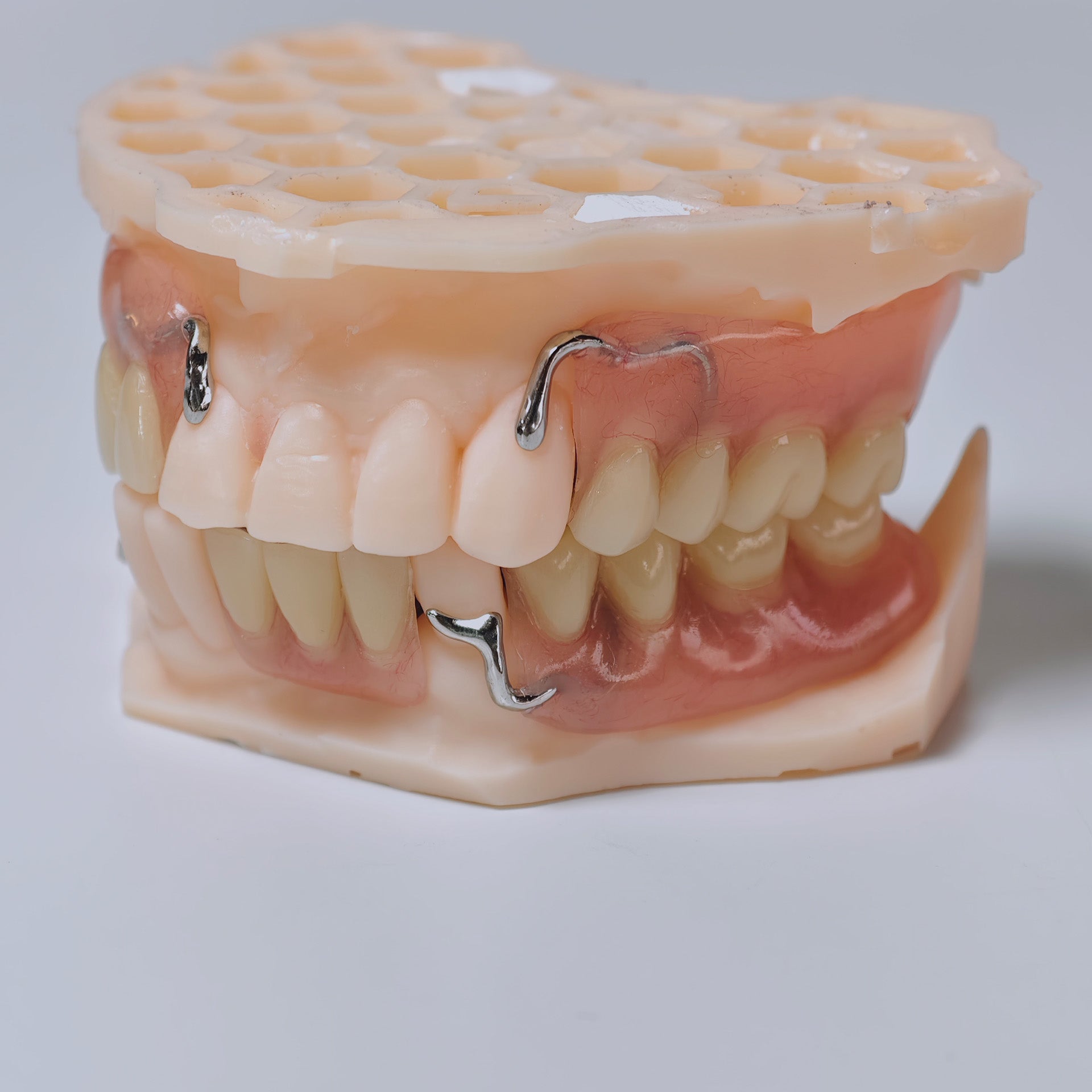 Cobalt Chrome Framework Denture Metal Framework With Acrylic Denture