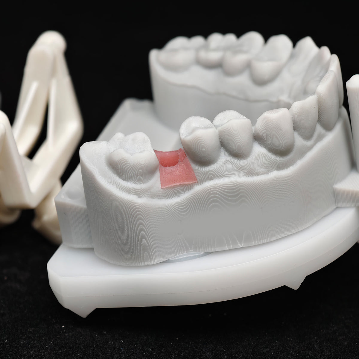 Custom Zirconia Implant Crowns