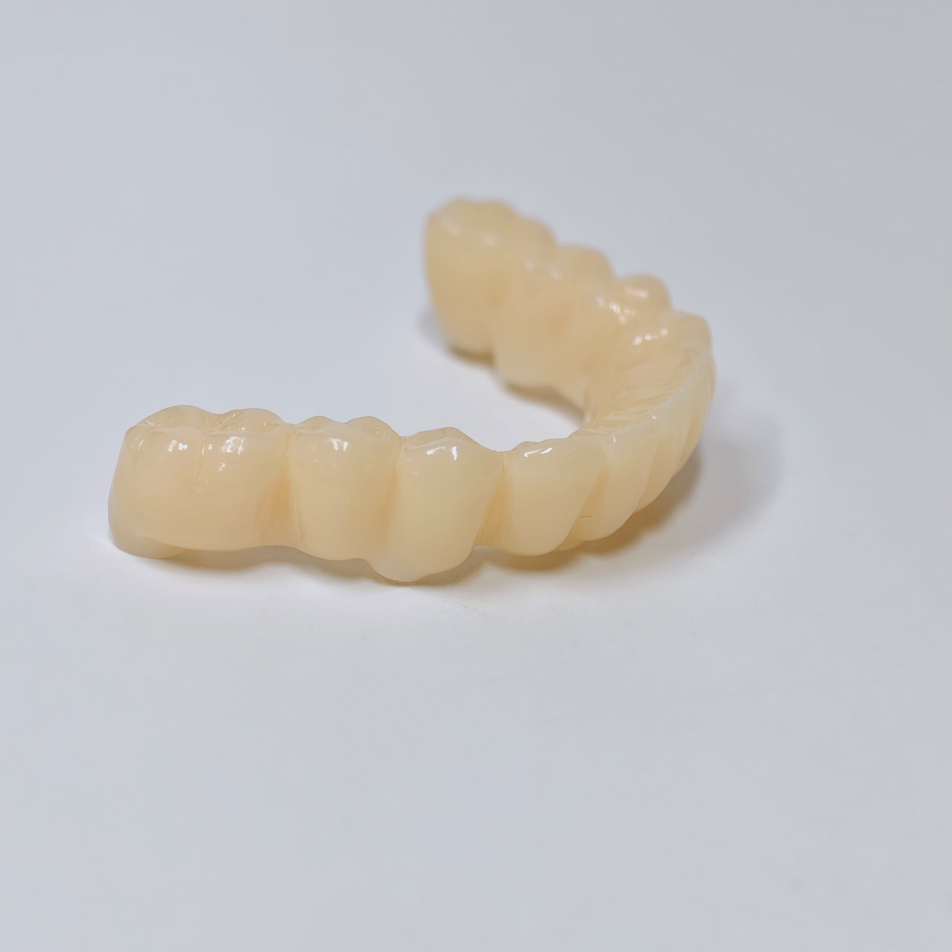 Custom Abutment And PMMA Bridge With Cement Retained And Implant Seating Guide