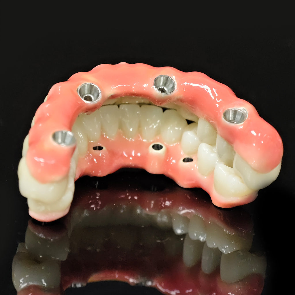 Enhanced Zirconia Crown Malo Bridge
