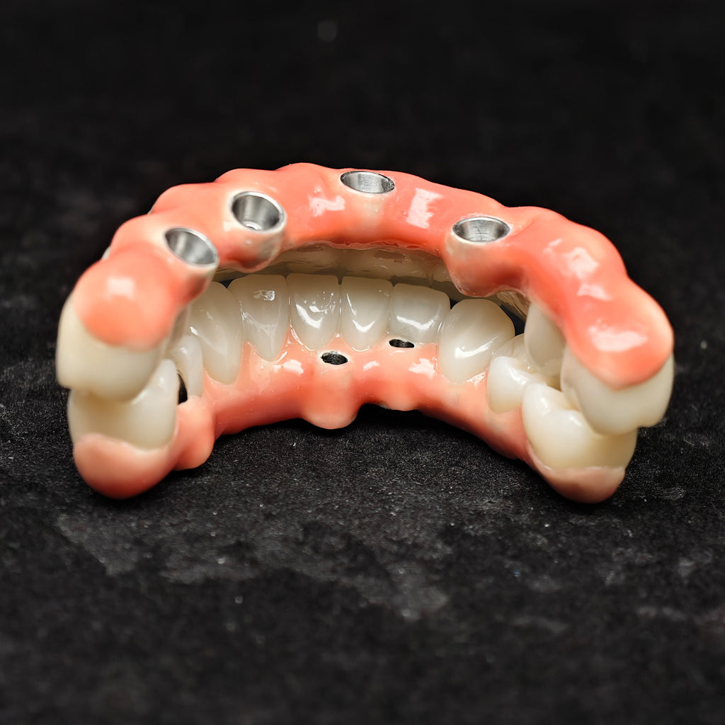 Enhanced Zirconia Crown Malo Bridge