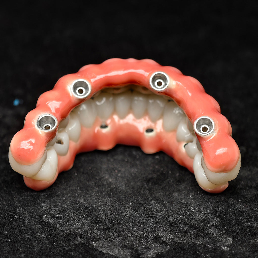 Enhanced Zirconia Crown Malo Bridge