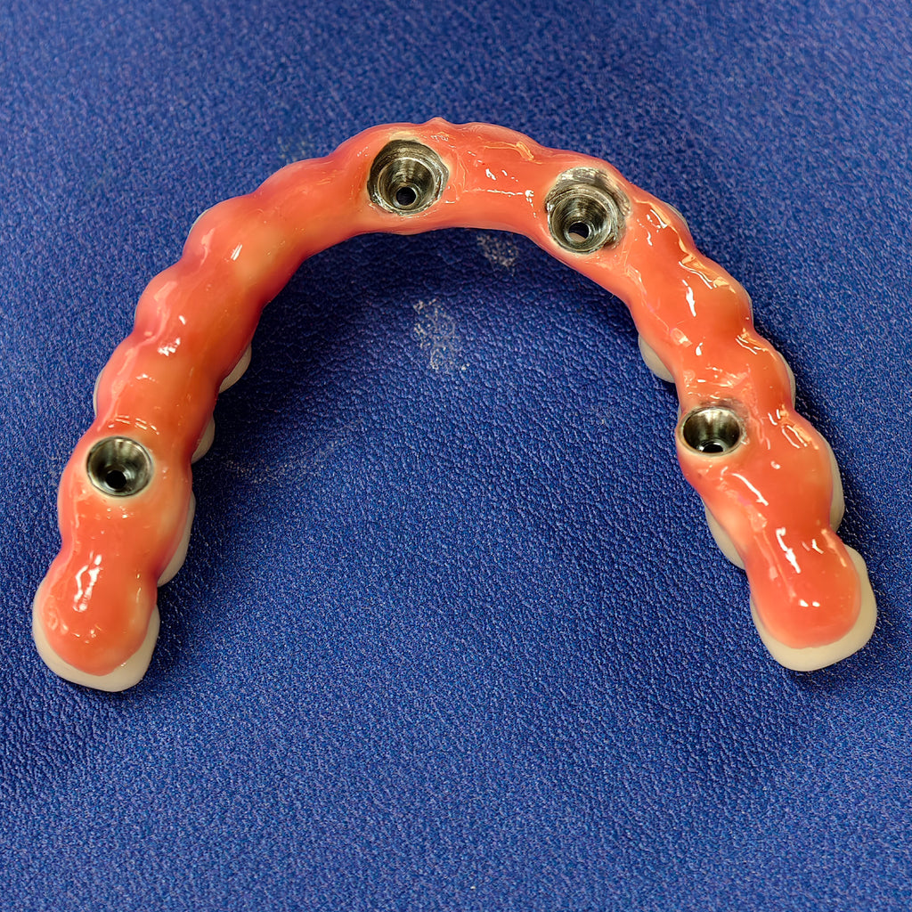 Enhanced Zirconia Crown Malo Bridge