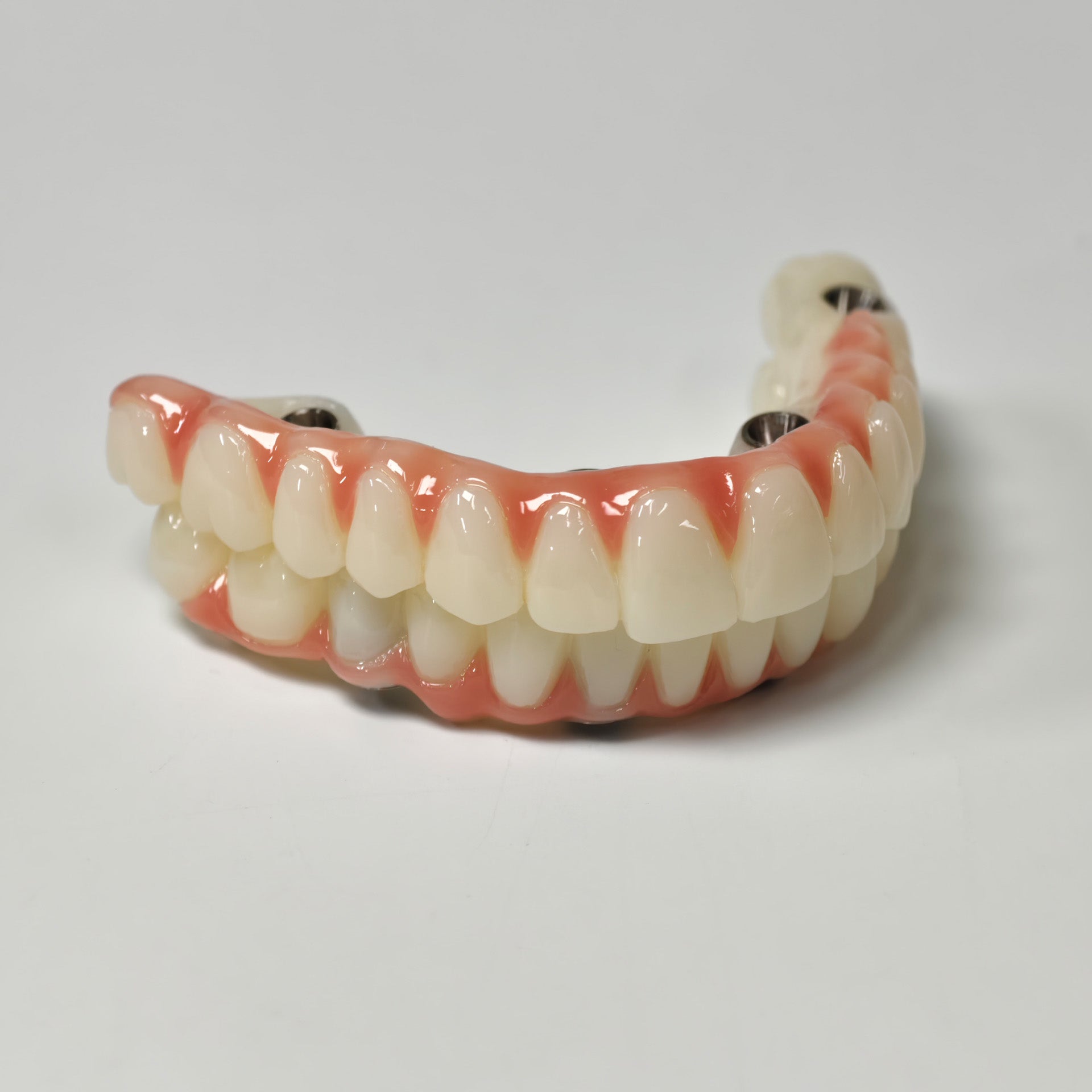 Full-Arch PMMA Bridge With Ti-Base Screw Retained