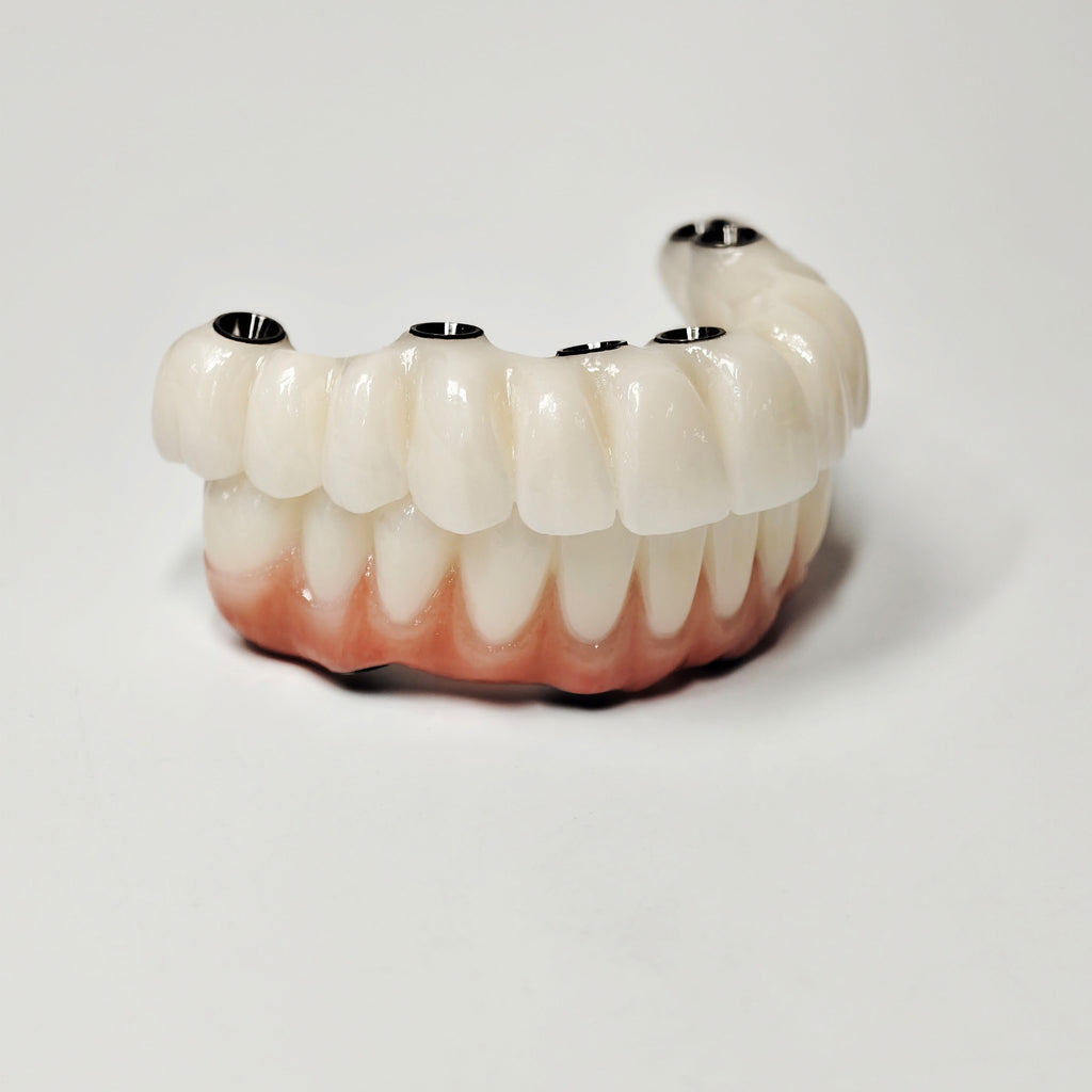 Full-Arch Zirconia Bridge With Ti-Base Abutment