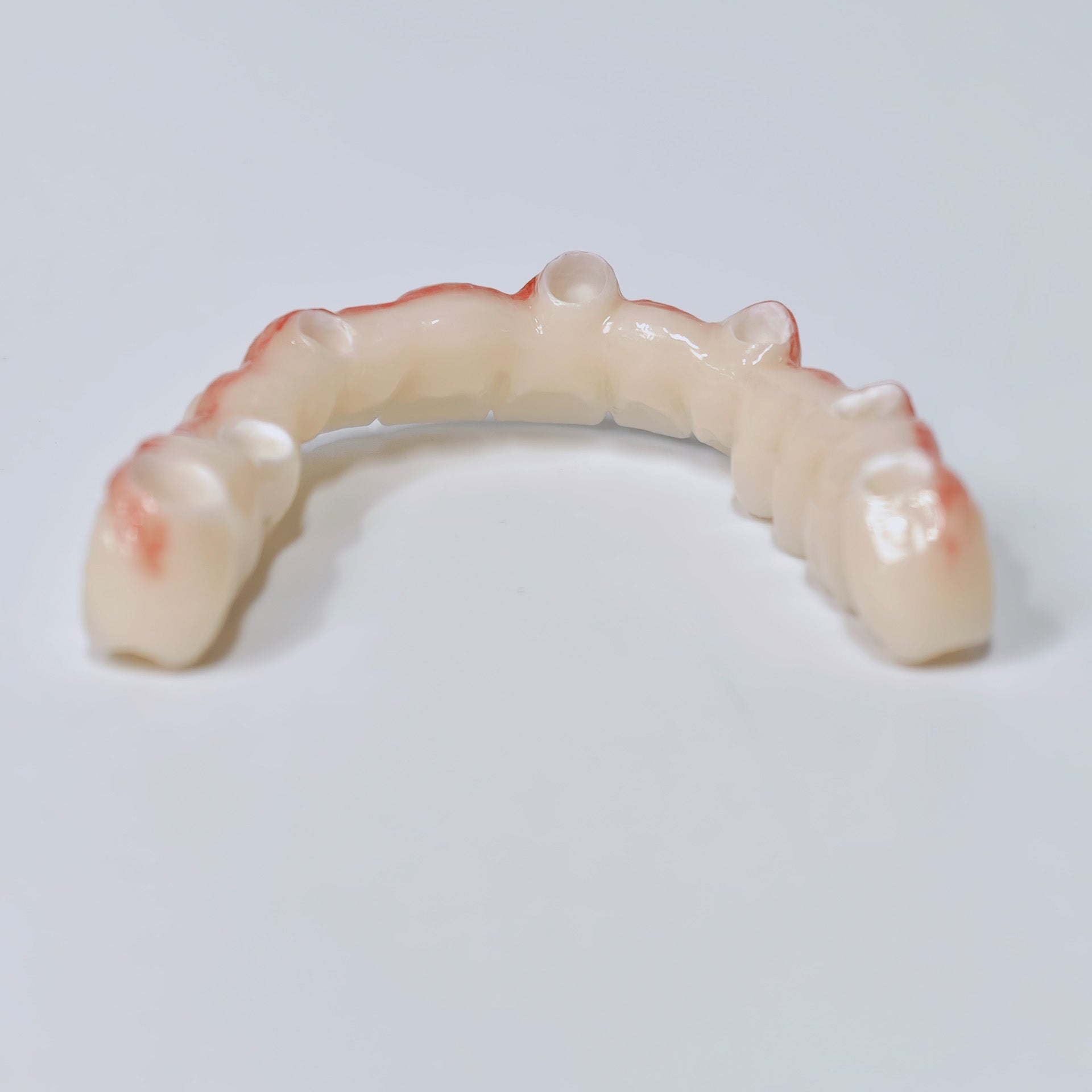 Half-Mouth Zirconia Bridge With Cement-Retained