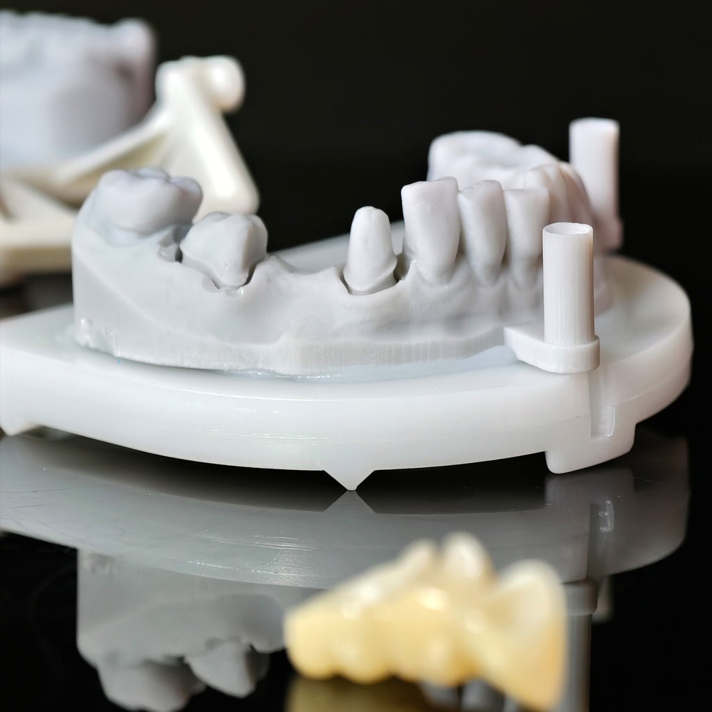 High - Strength Zirconia Bridge