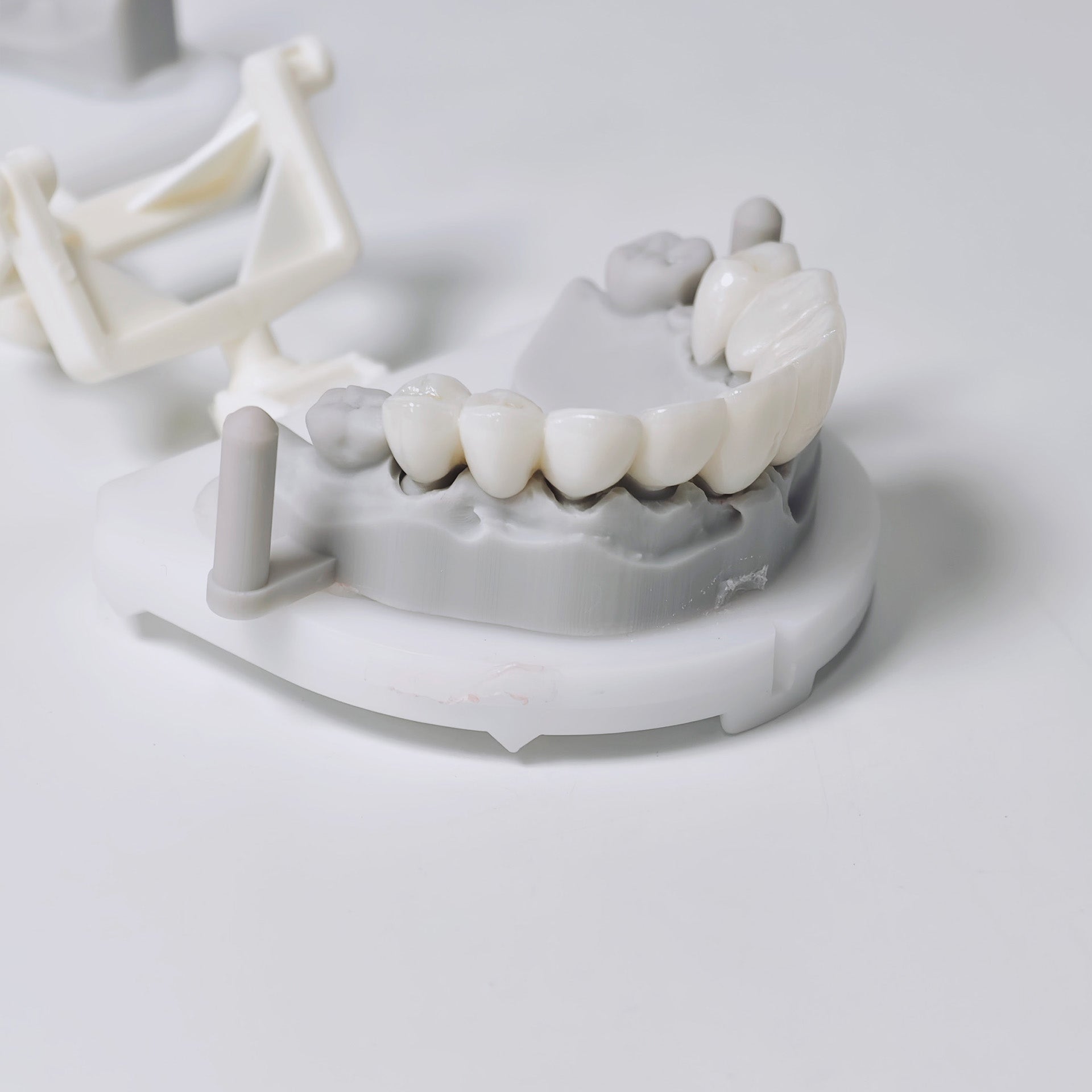High - Strength Zirconia Bridge Aesthetic