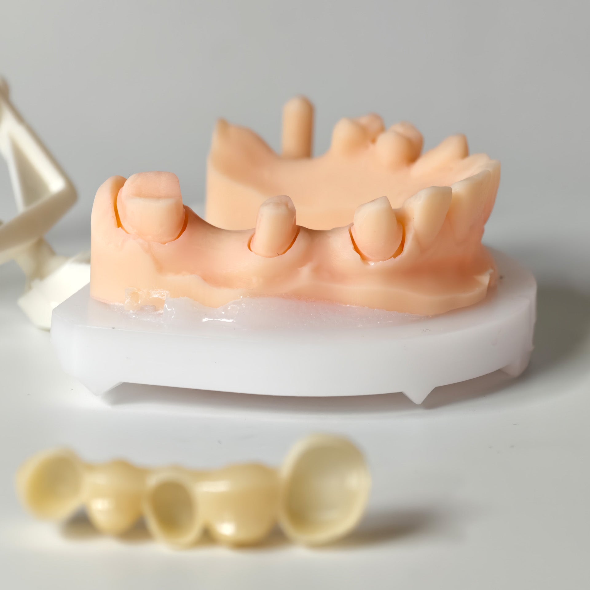 High - Strength Zirconia Bridge