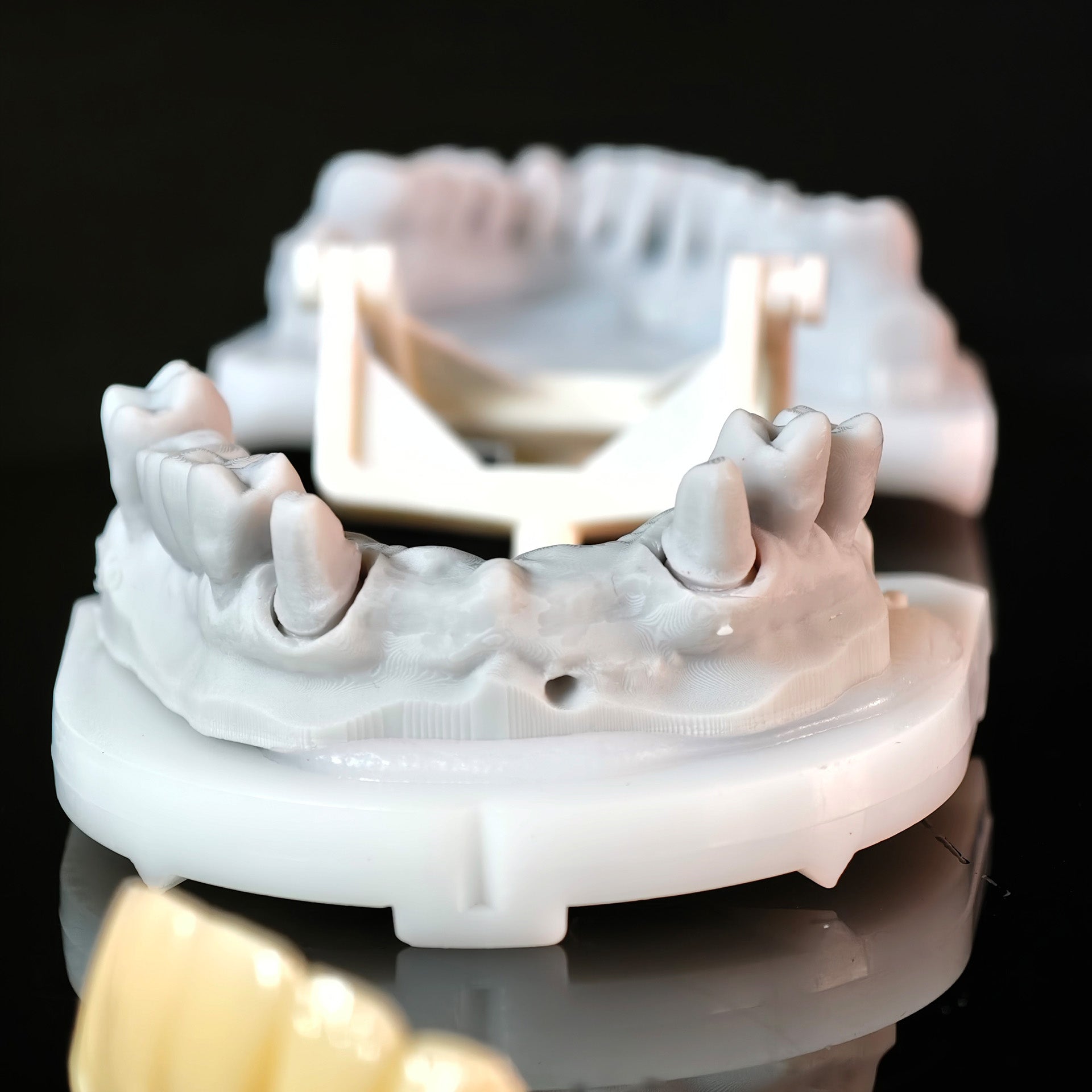 High - Strength Zirconia Bridge