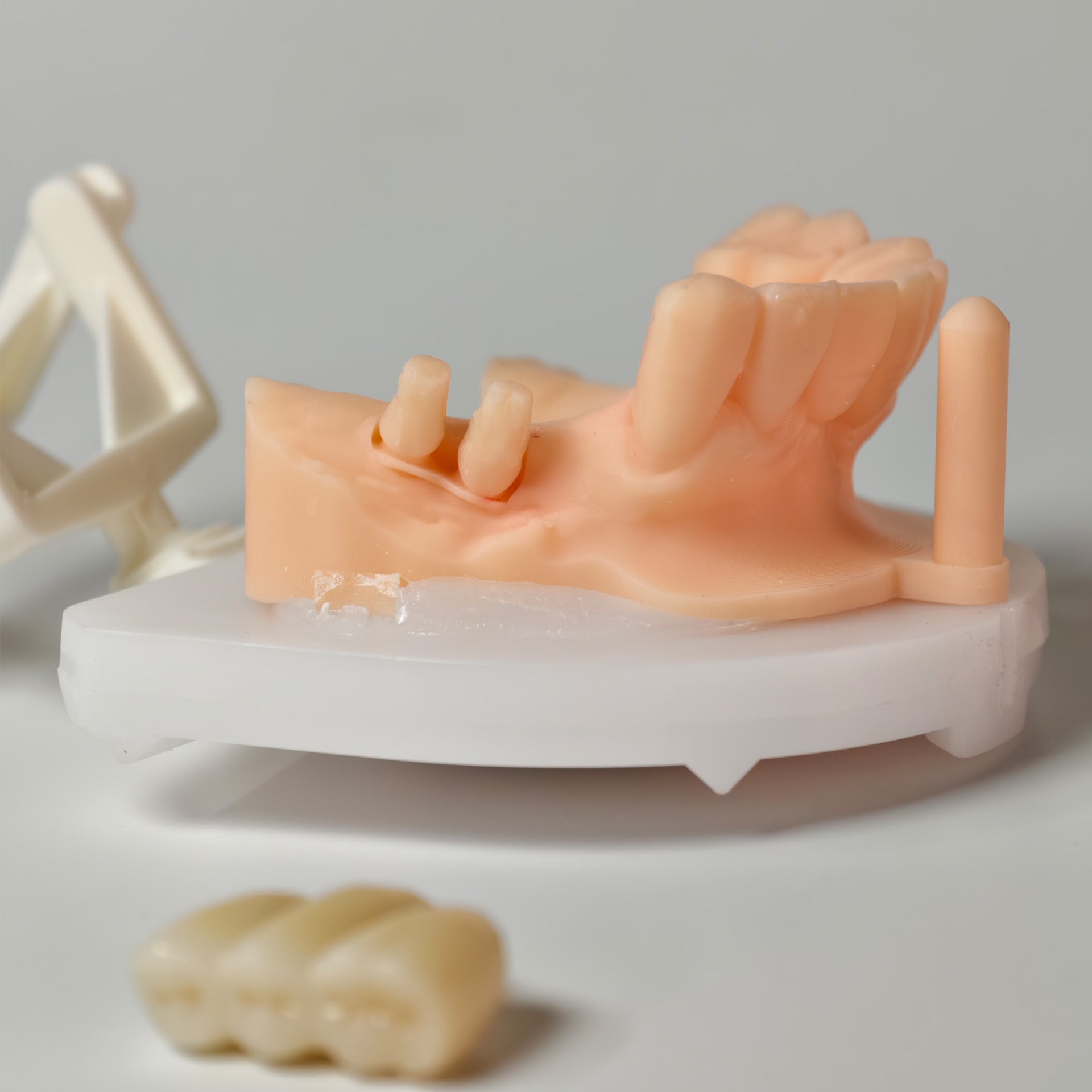 High - Strength Zirconia Bridge