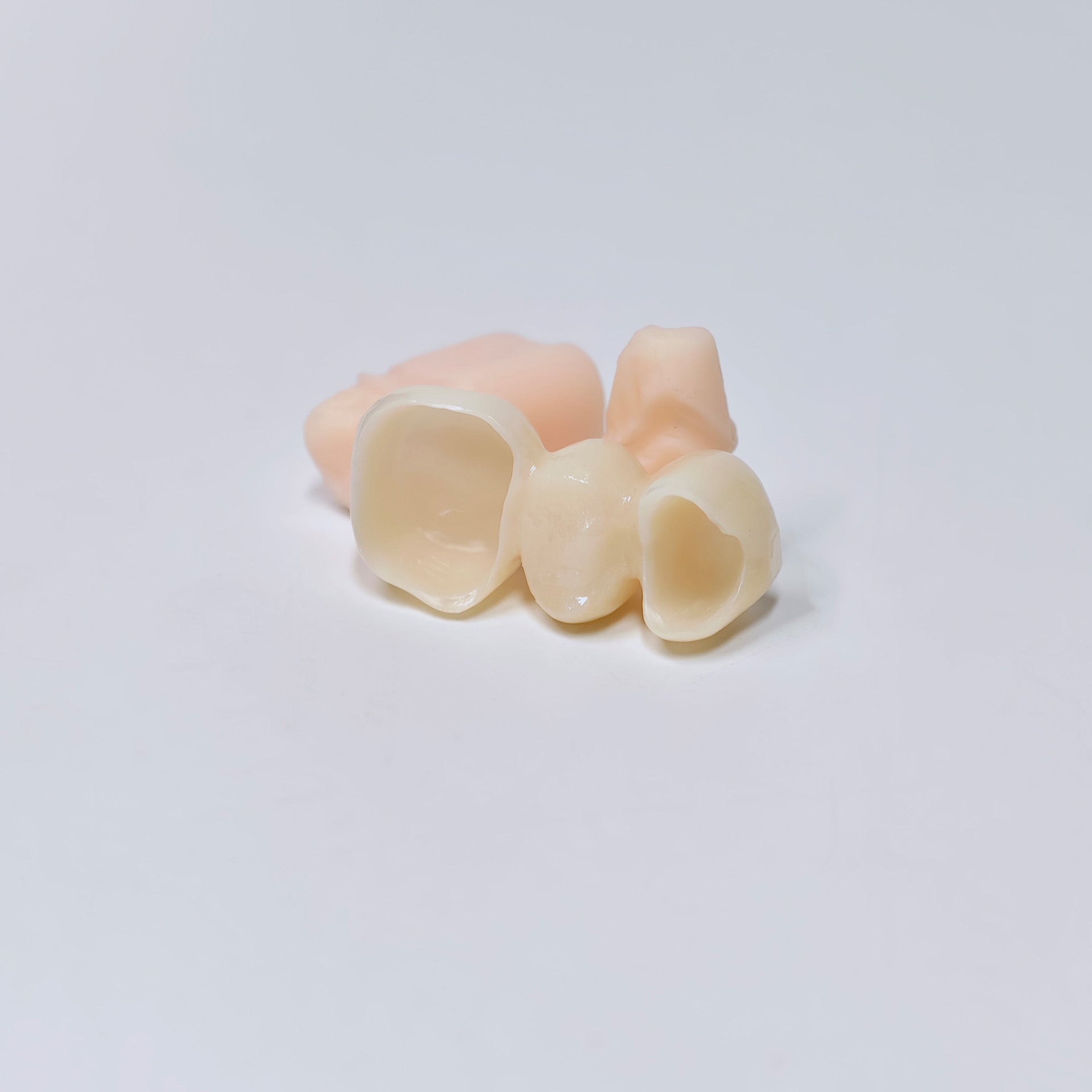 High - Strength Zirconia Bridge