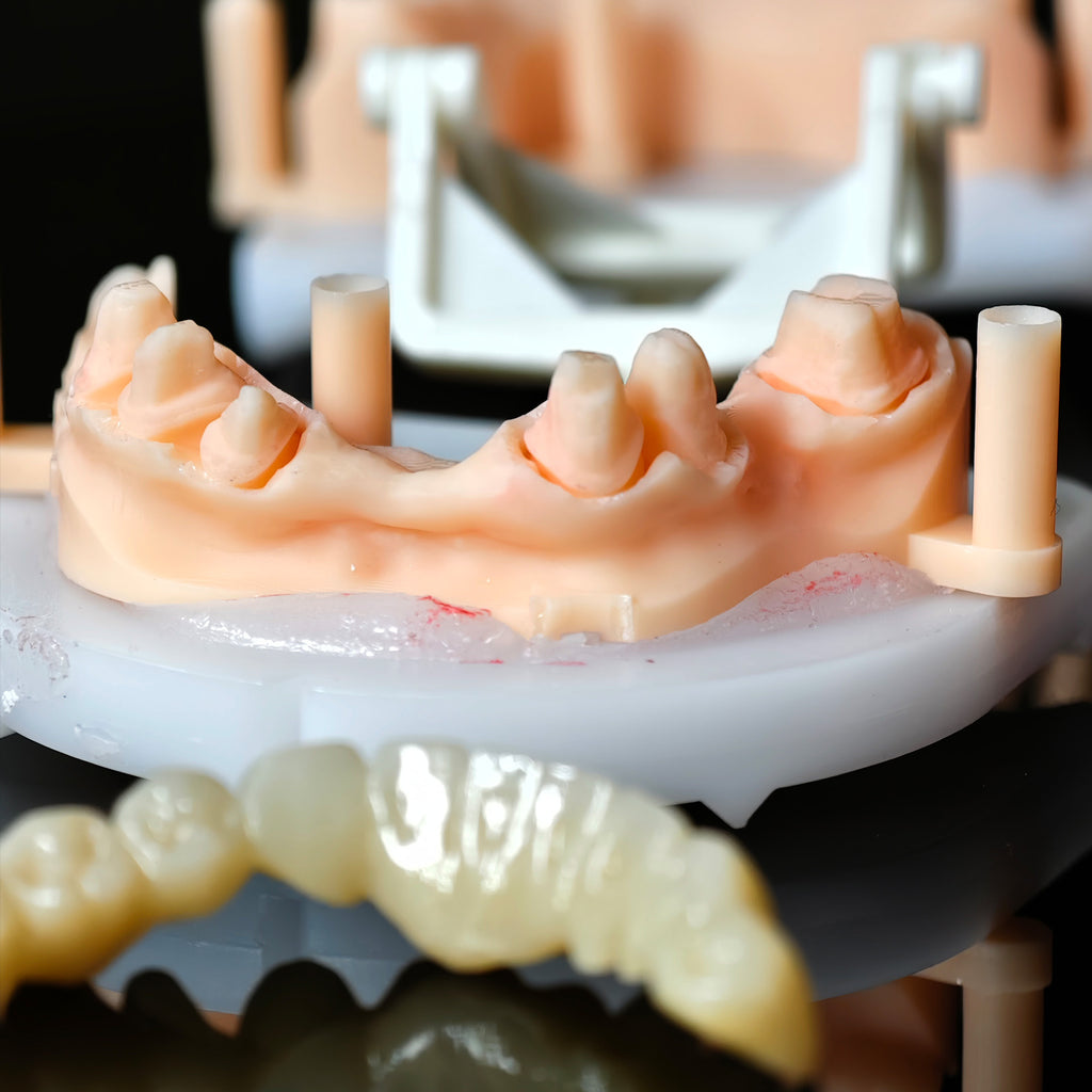 High - Strength Zirconia Bridge