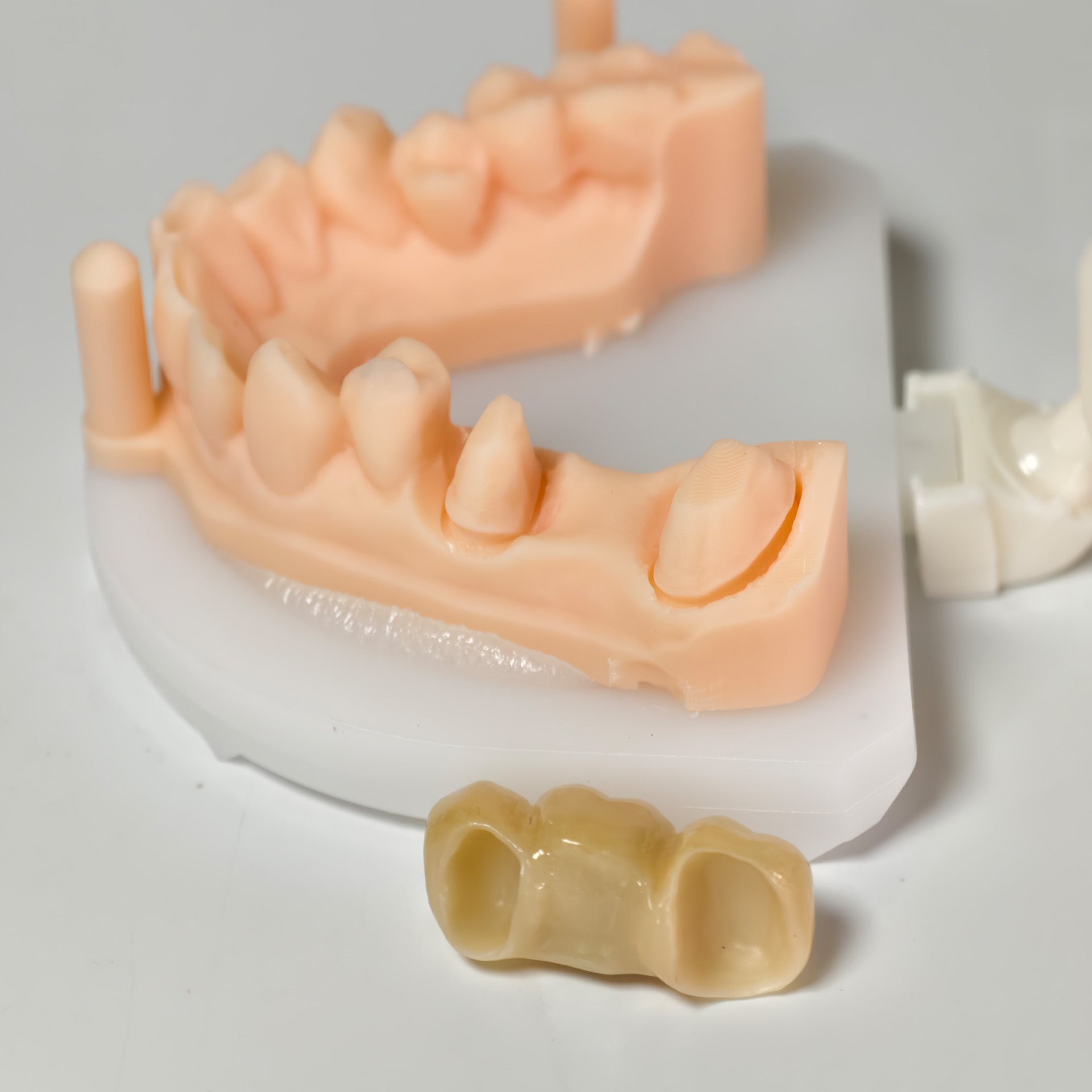High - Strength Zirconia Bridge