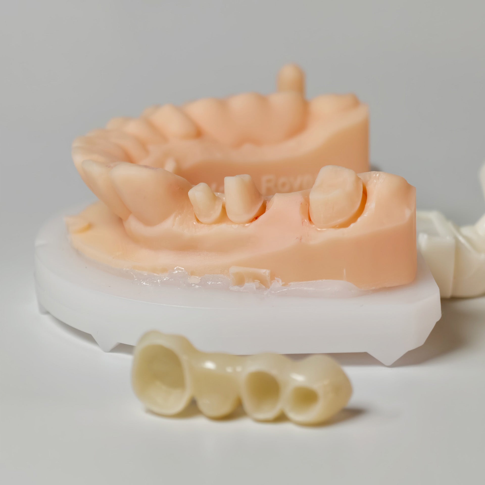 High - Strength Zirconia Bridge