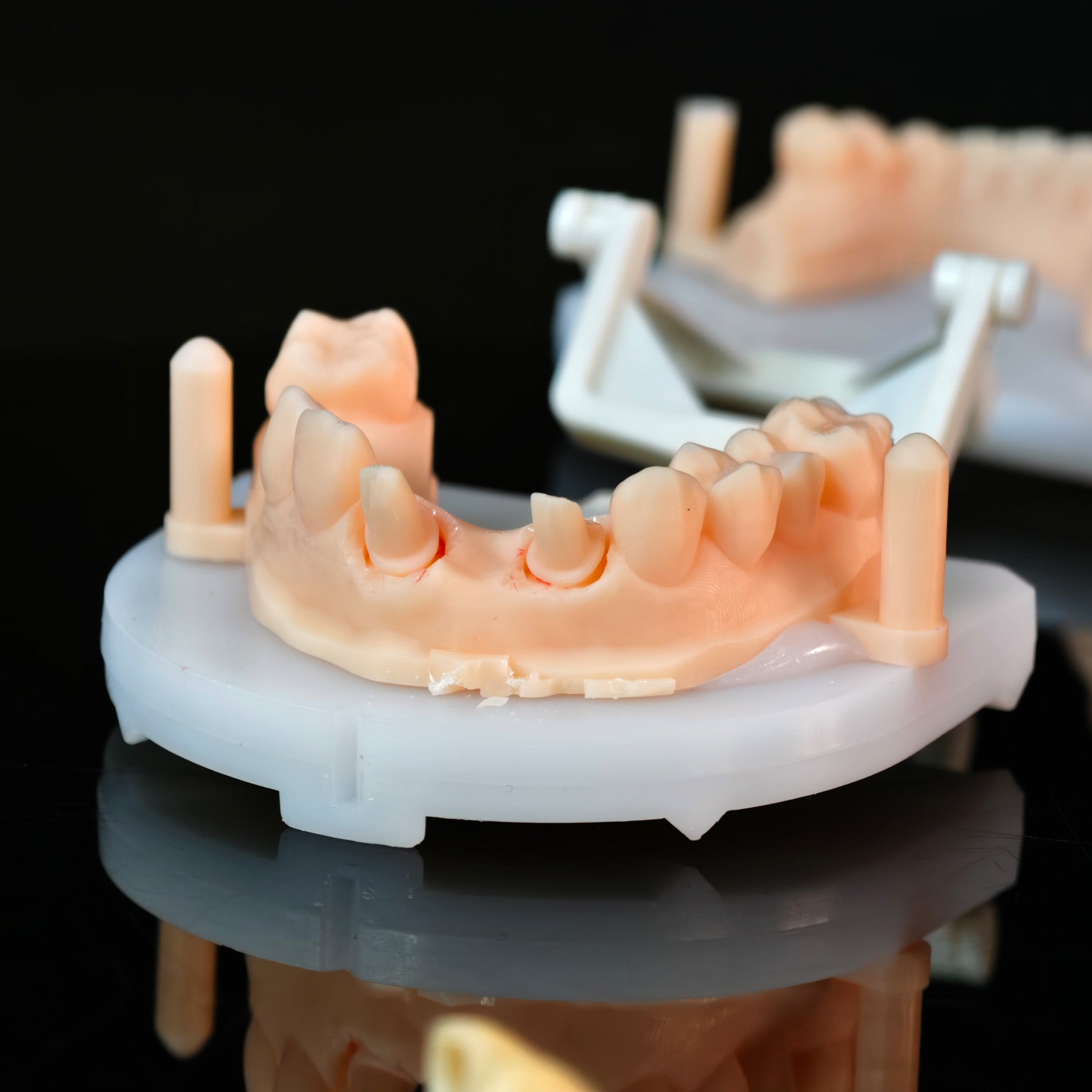 High - Strength Zirconia Bridge
