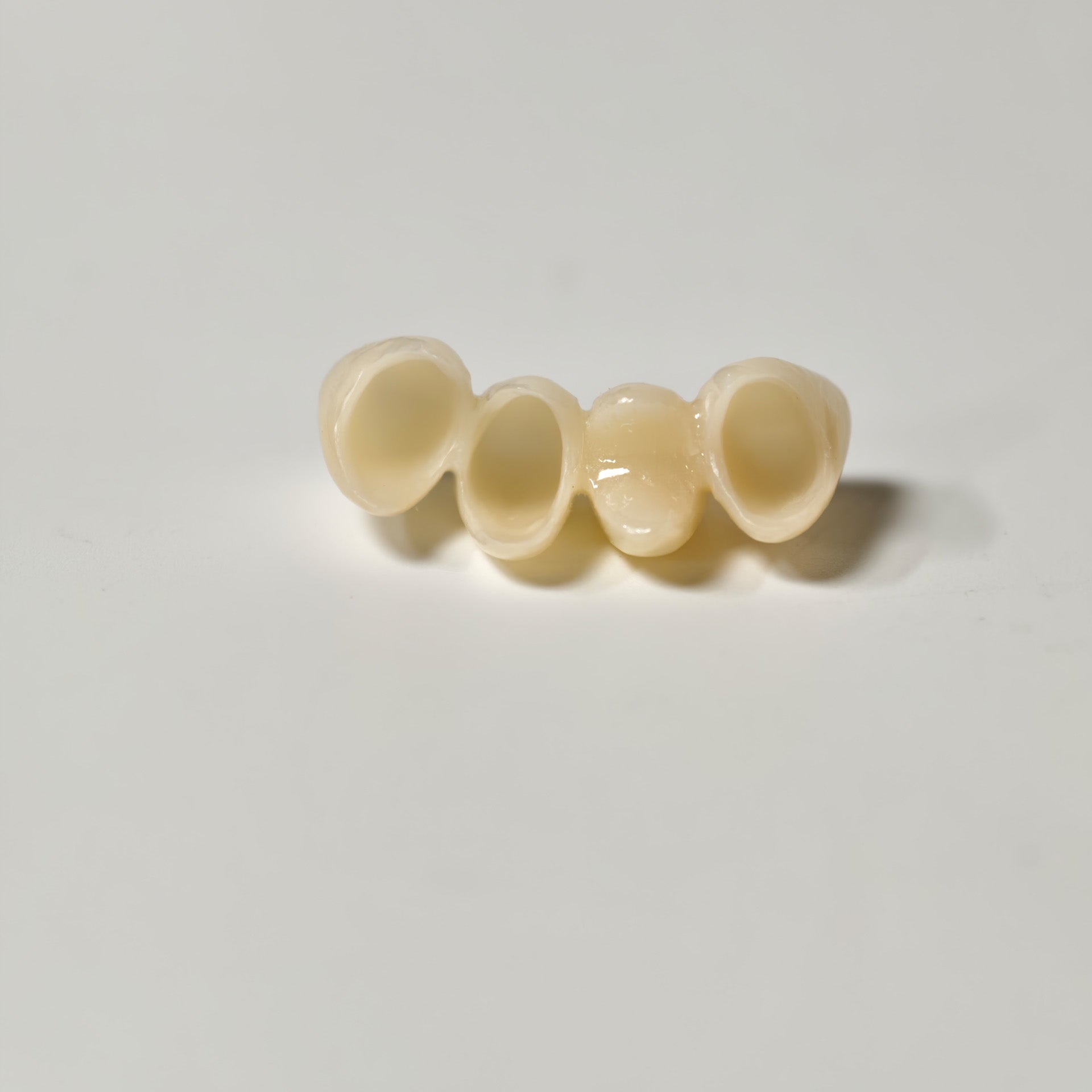 High - Strength Zirconia Bridge