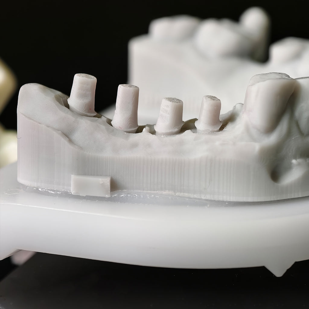 High - Strength Zirconia Bridge