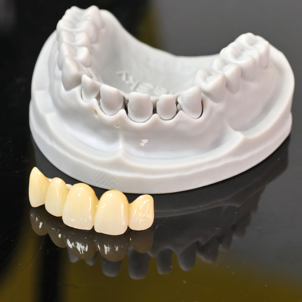 High - Strength Zirconia Bridge