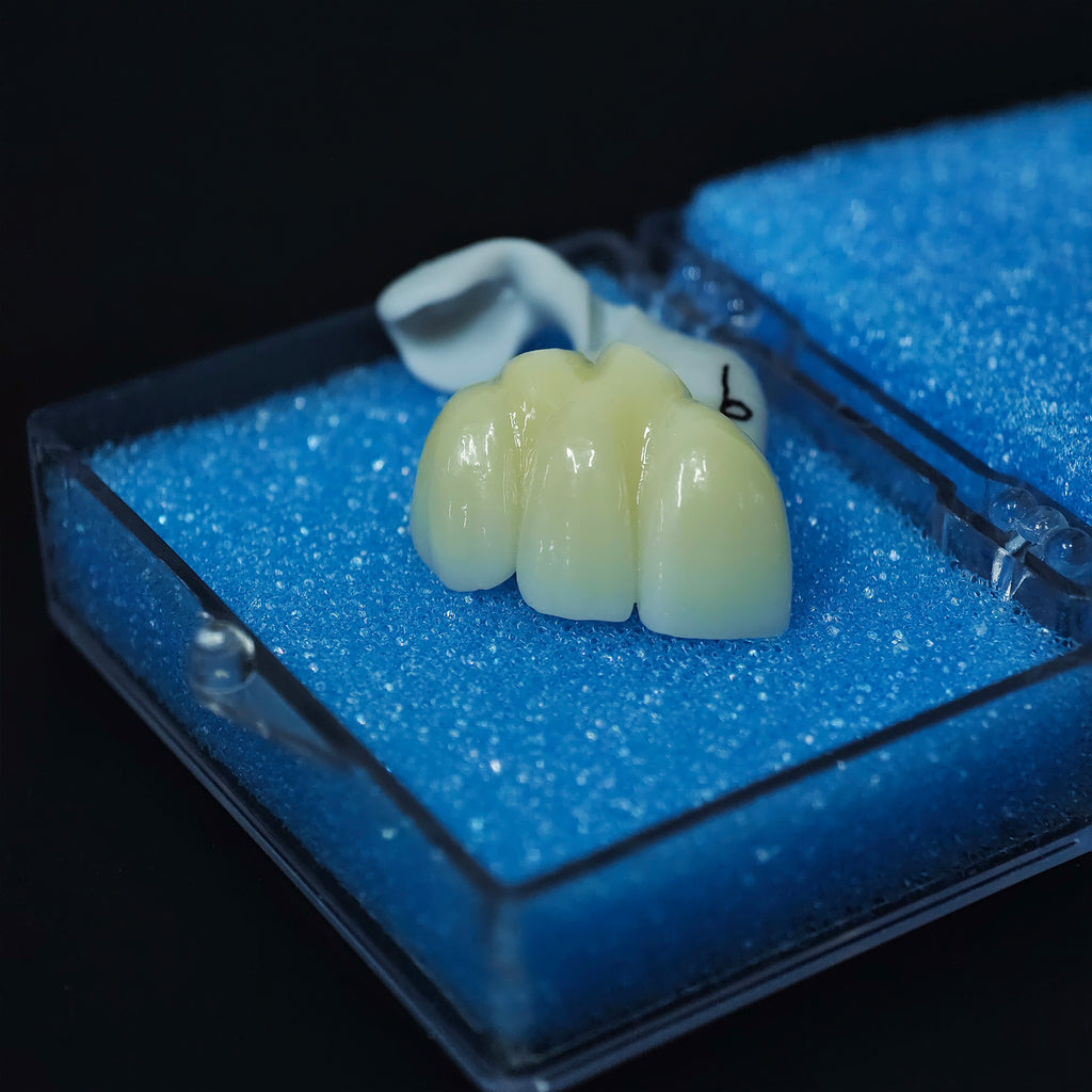 High - Strength Zirconia Bridge