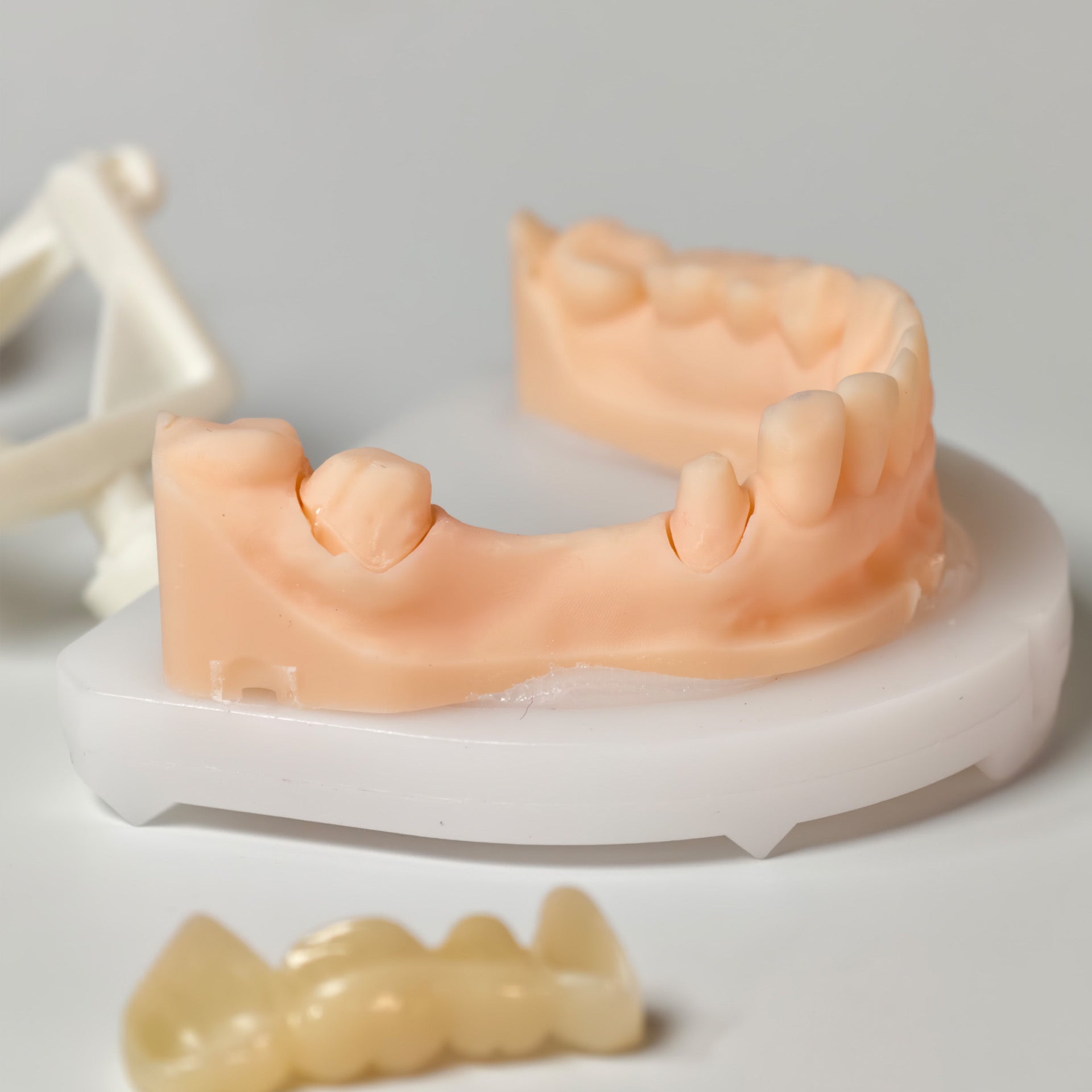 High - Strength Zirconia Bridge