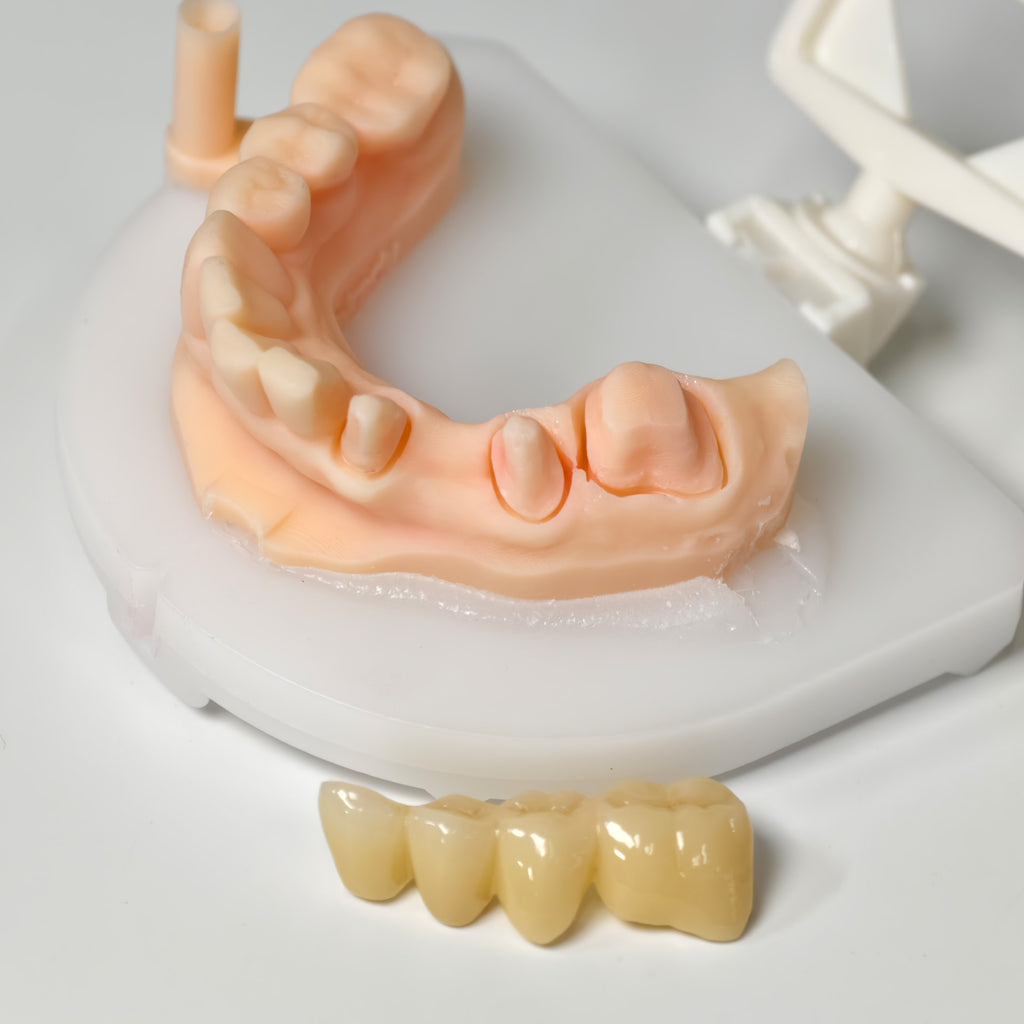 High - Strength Zirconia Bridge