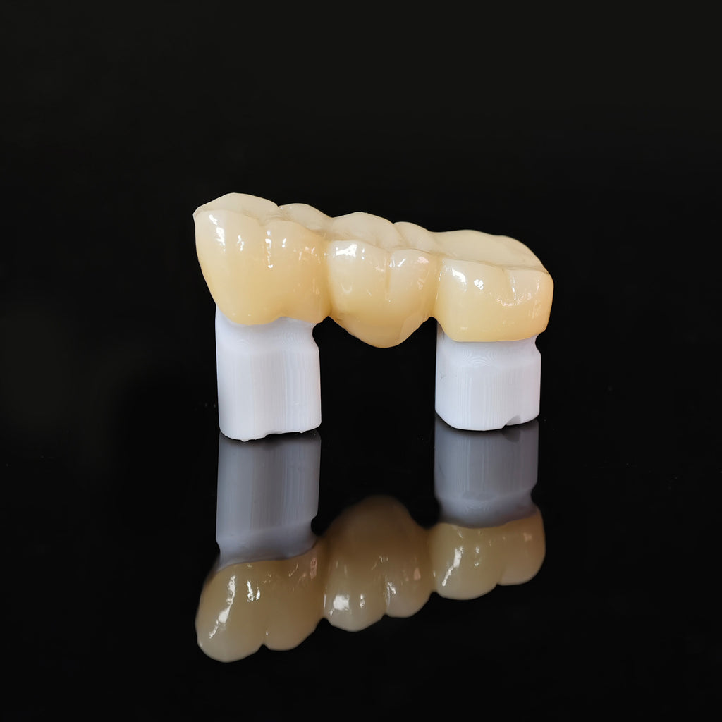 High - Strength Zirconia Bridge
