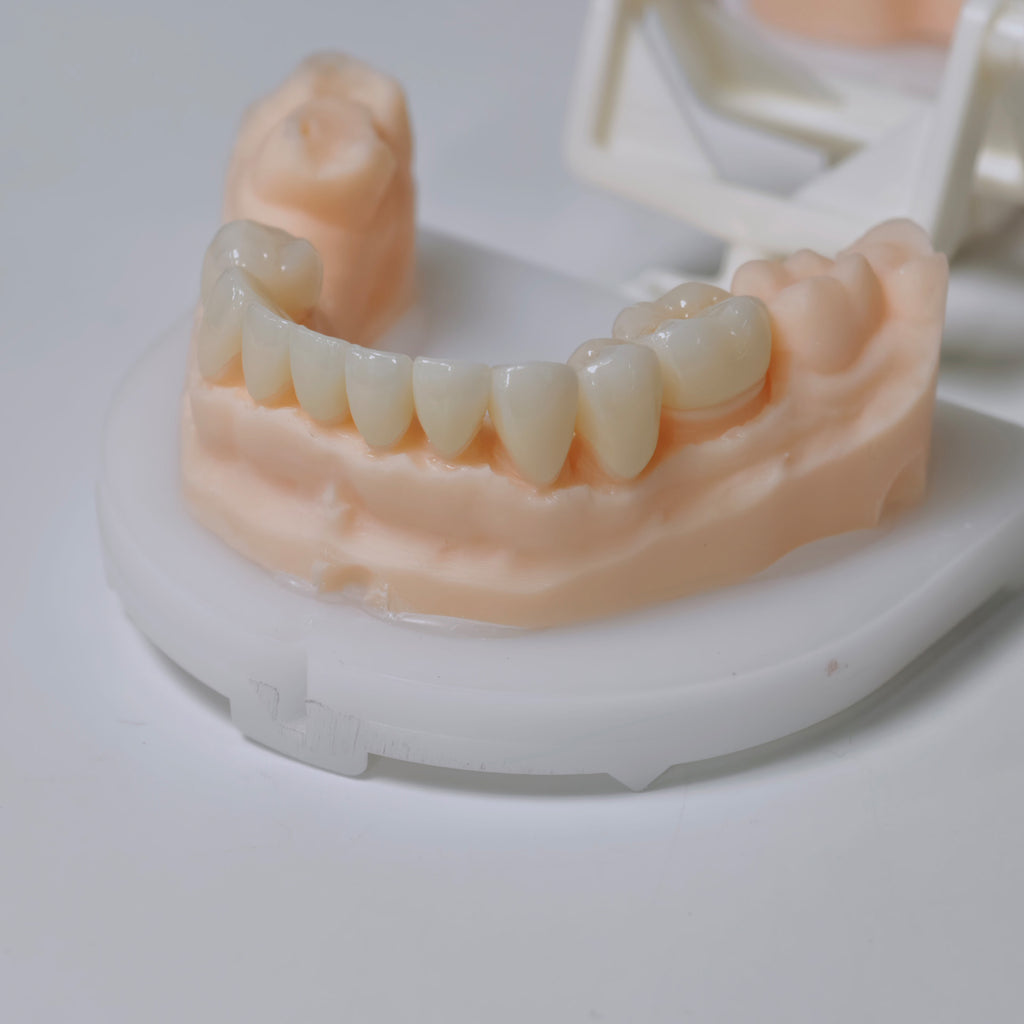 High - Strength Zirconia Bridge And Crown