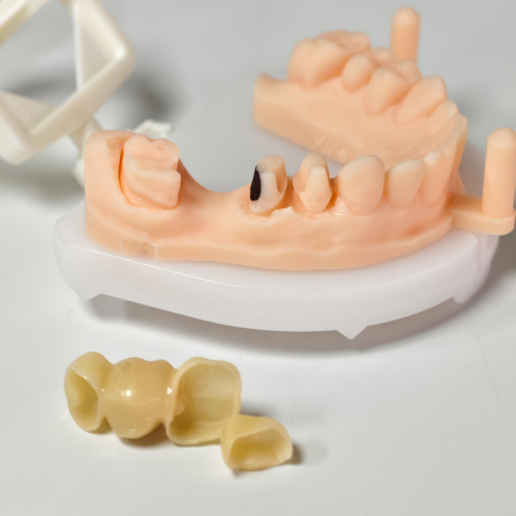 High - Strength Zirconia Bridge And Crown
