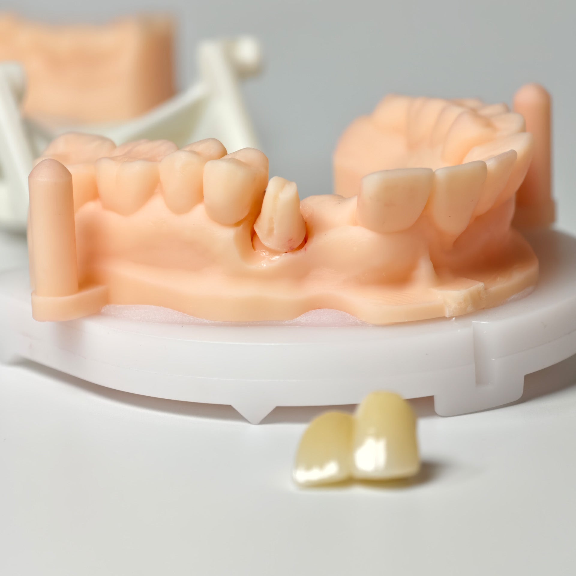 High - Strength Zirconia Crown
