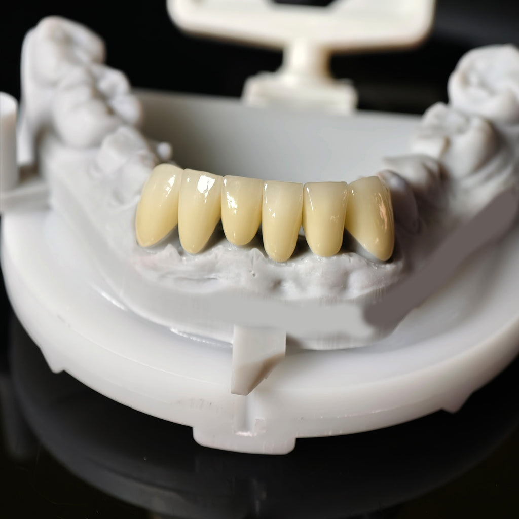 High - Strength Zirconia Crowns