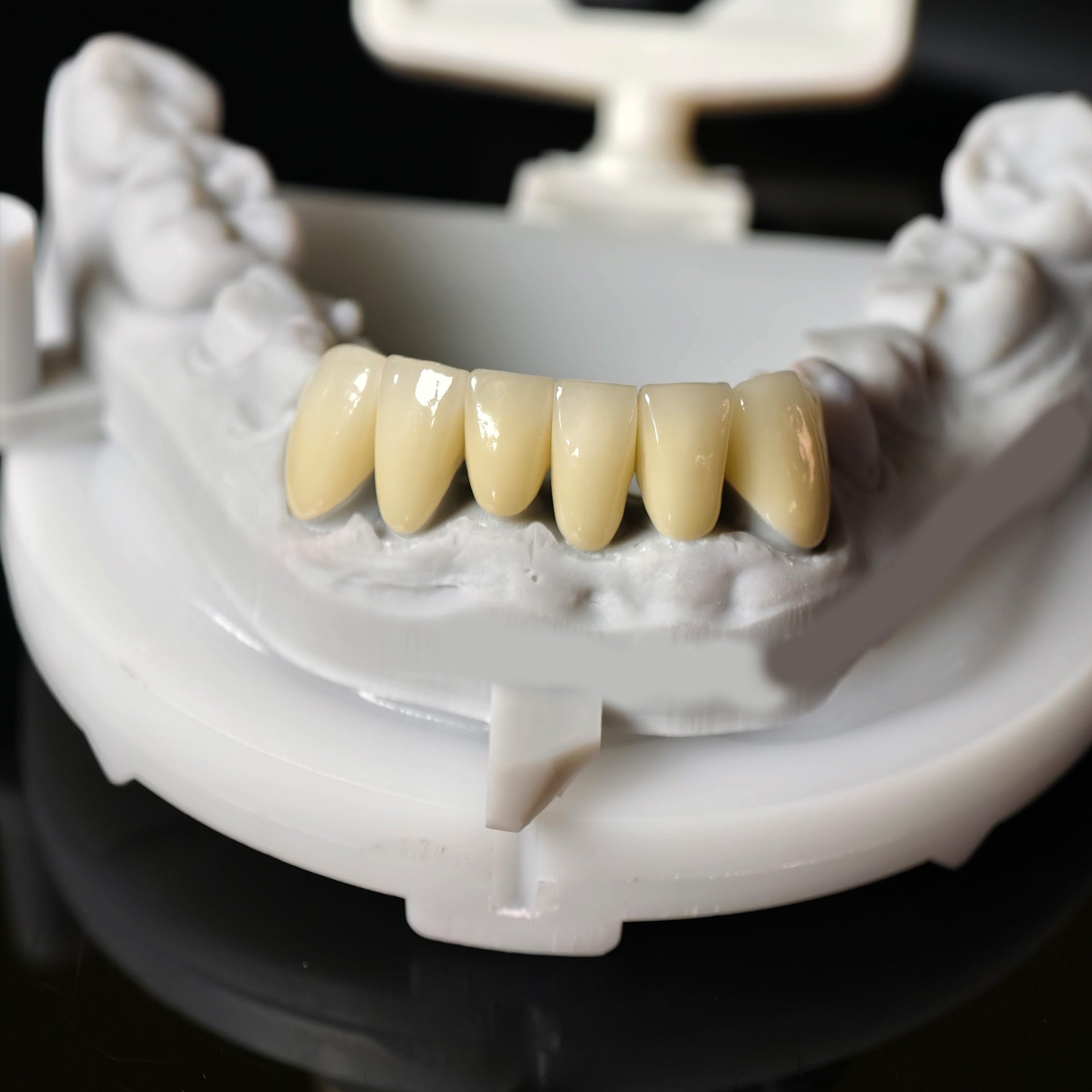 High - Strength Zirconia Crowns