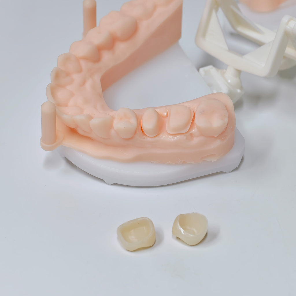 High - Strength Zirconia Crowns
