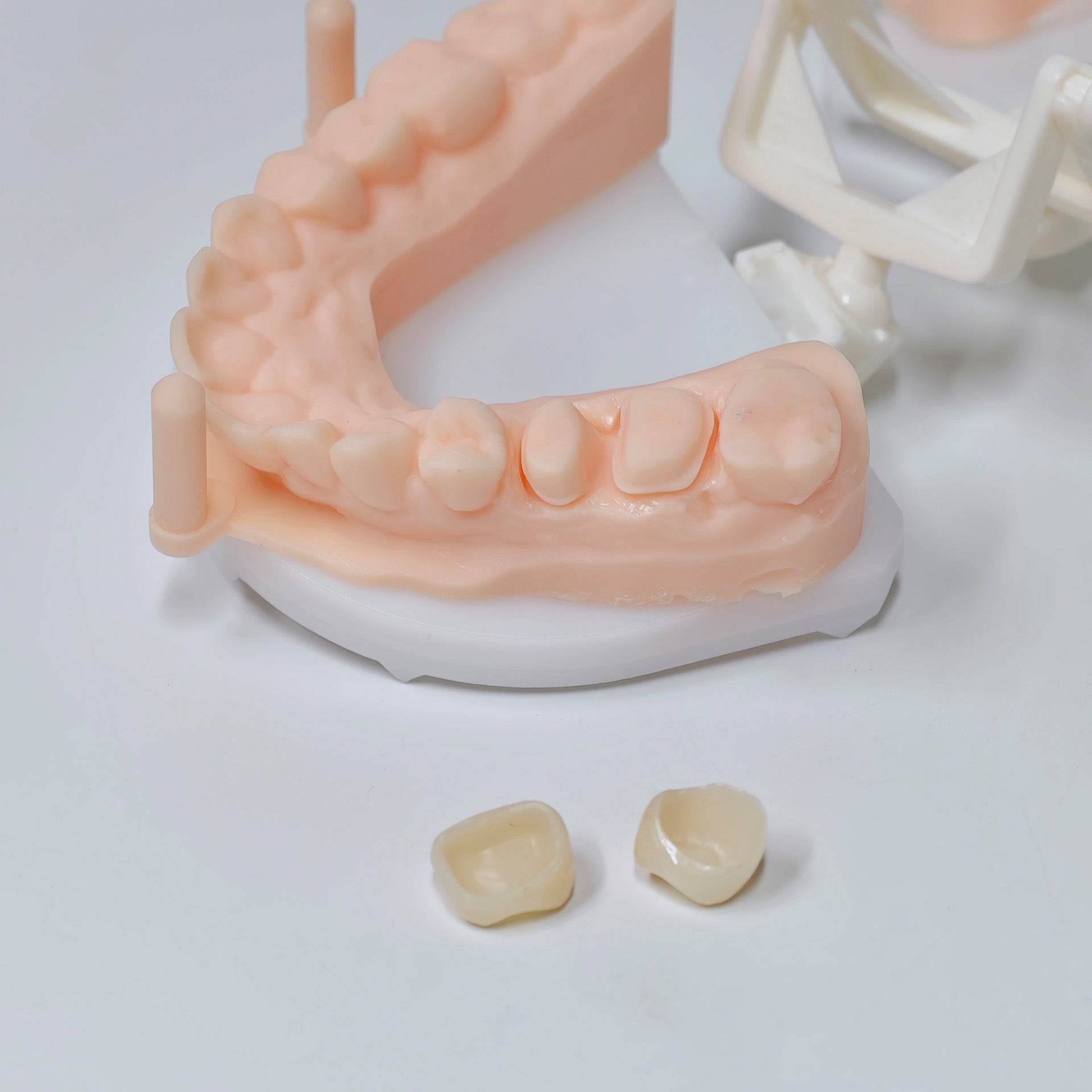 High - Strength Zirconia Crowns
