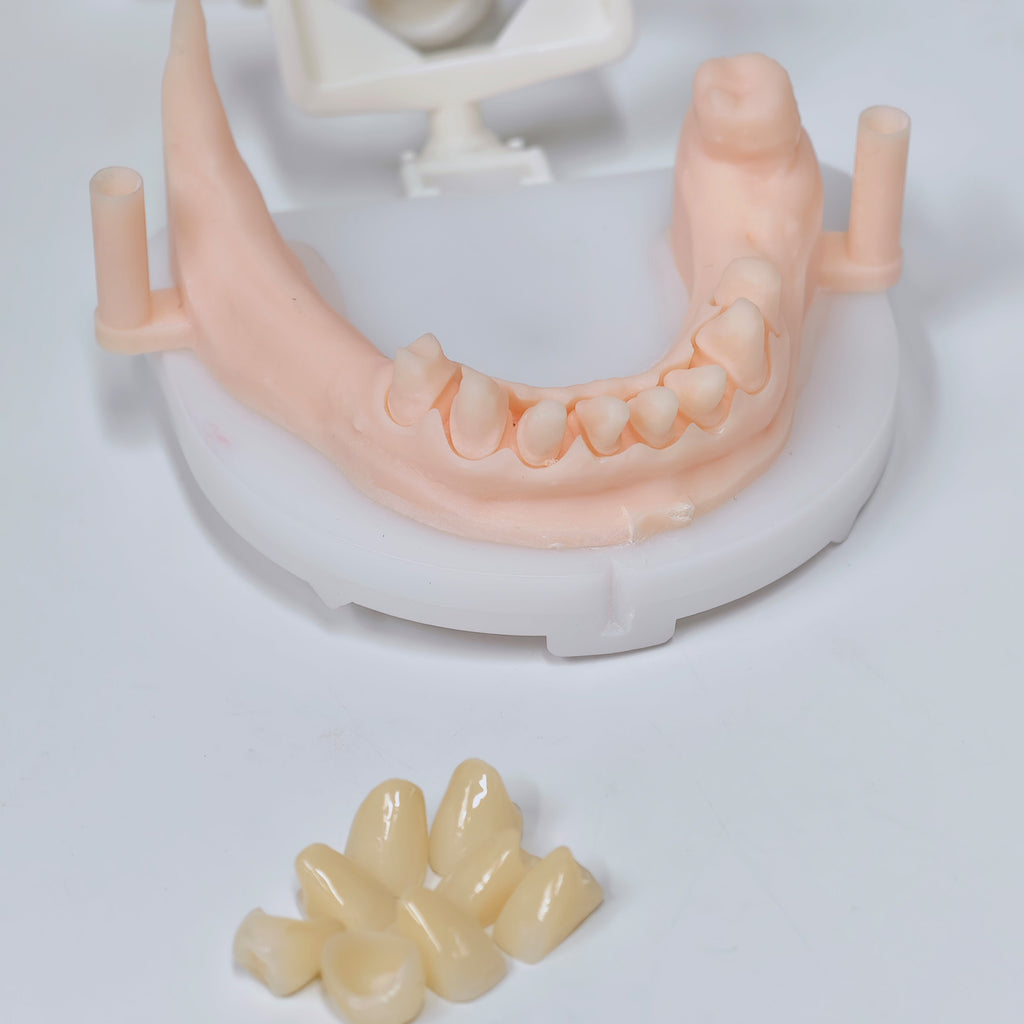 High - Strength Zirconia Crowns