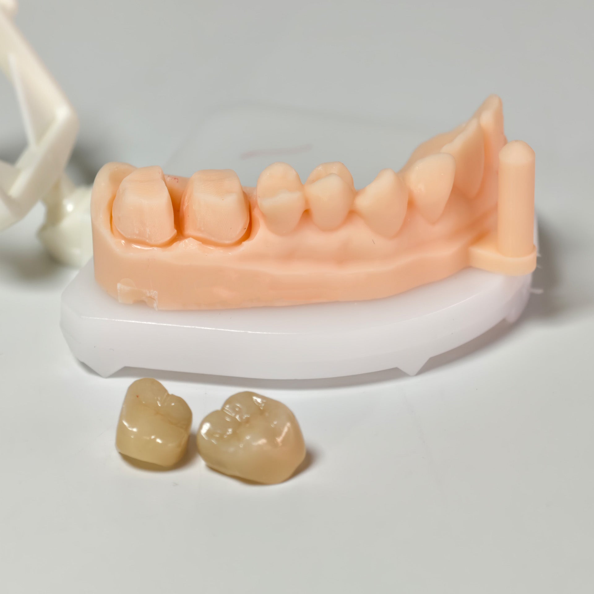 High - Strength Zirconia Crowns