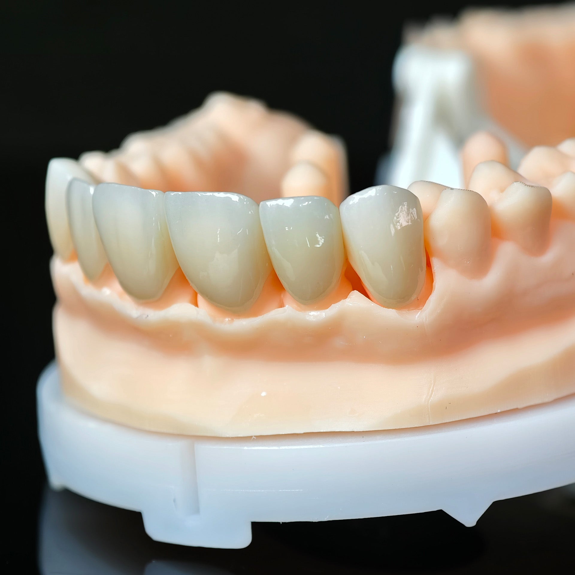 High - Strength Zirconia Crowns