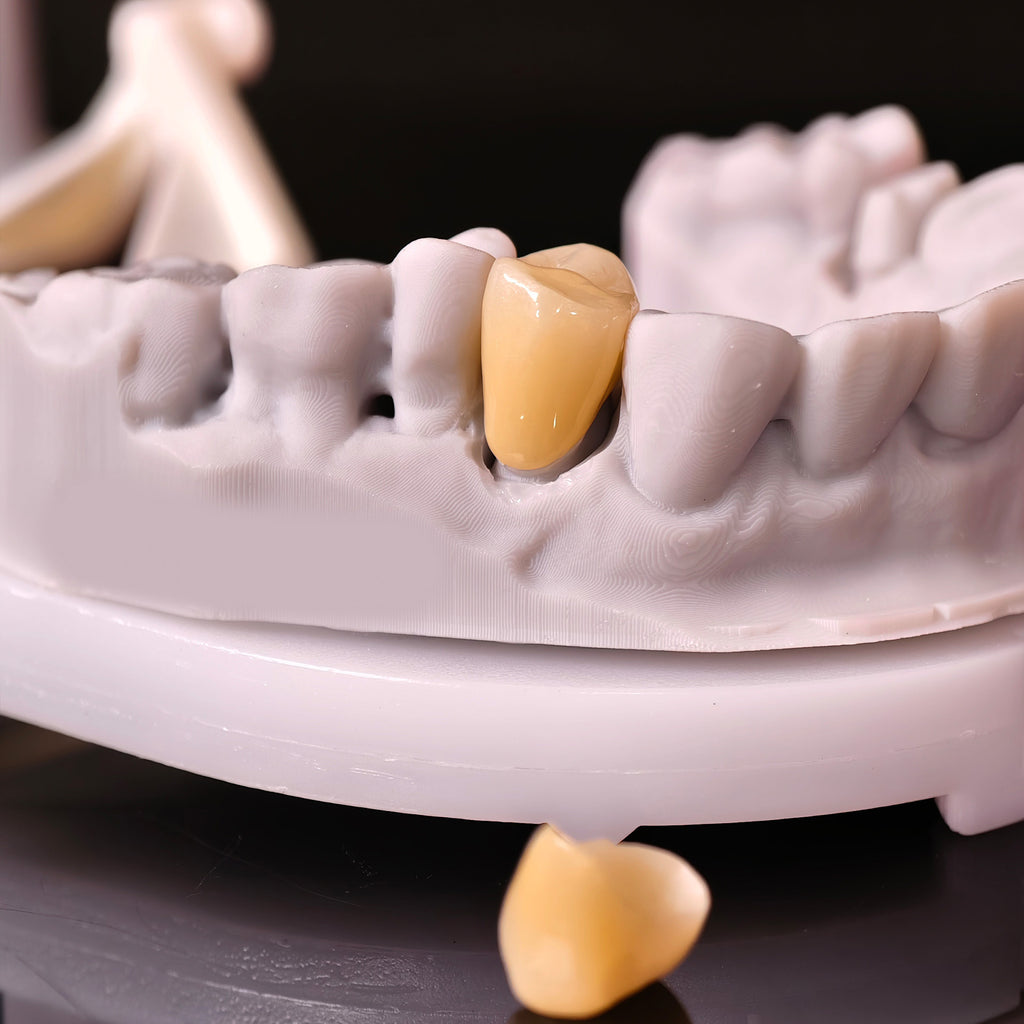High - Strength Zirconia Crowns