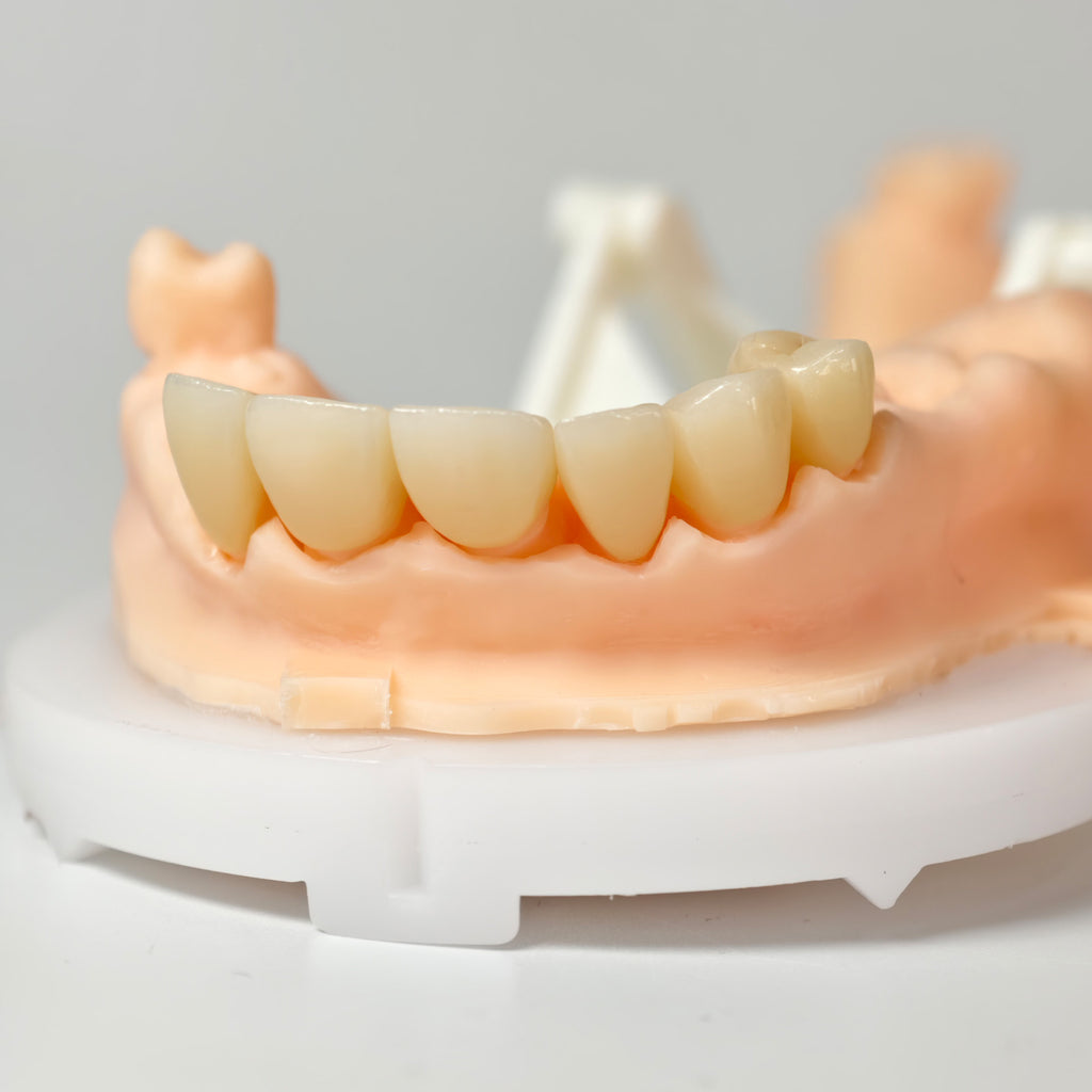 High - Strength Zirconia Crowns