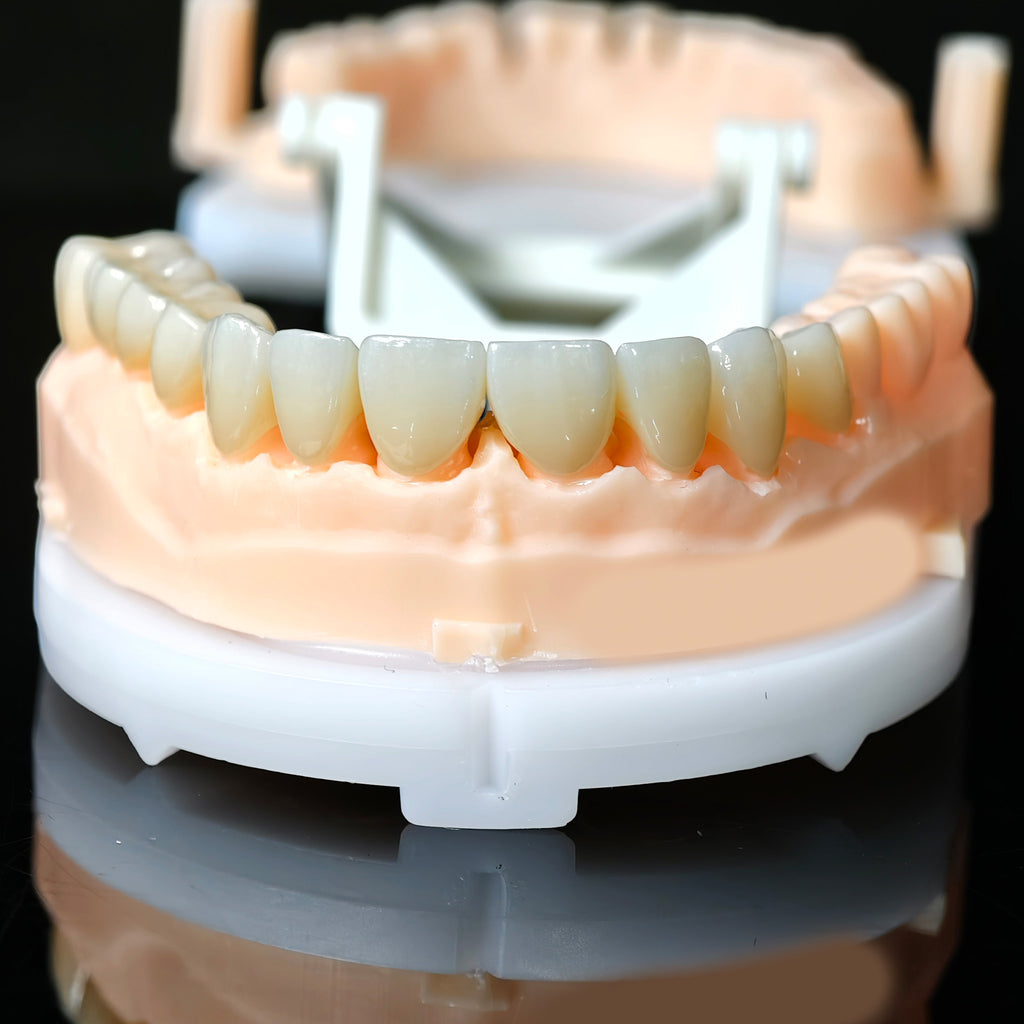 High - Strength Zirconia Crowns And Bridge