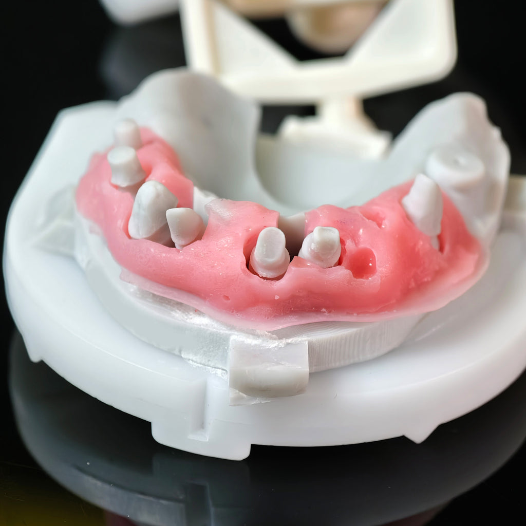 High - Strength Zirconia Crowns And Bridge