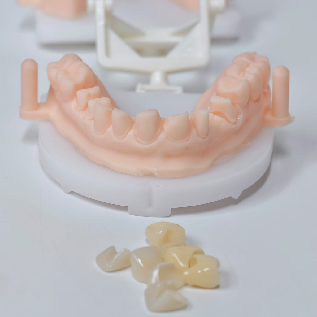 High - Strength Zirconia Crowns And Ceramic Veneers