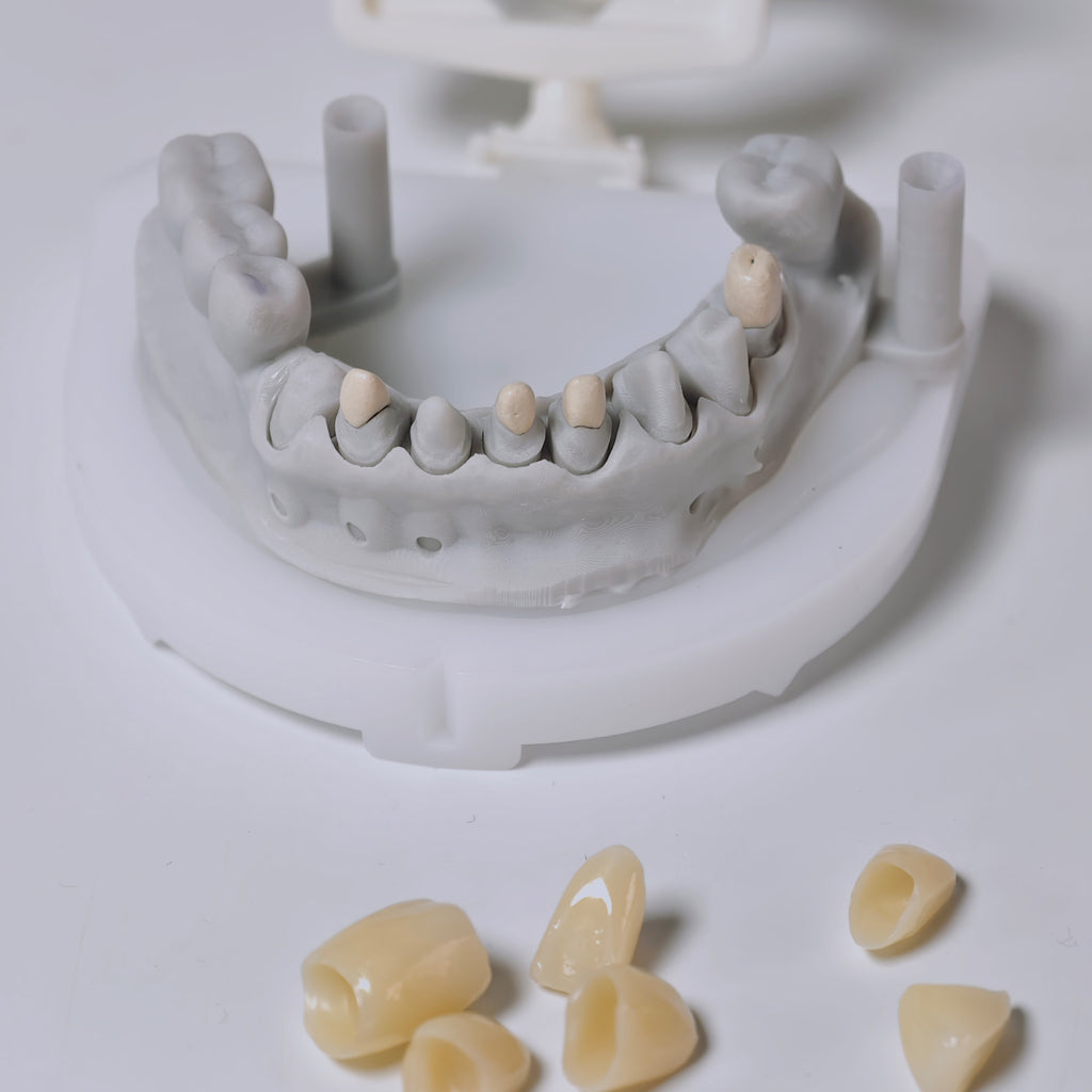 High - Strength Zirconia Crown with Post and core