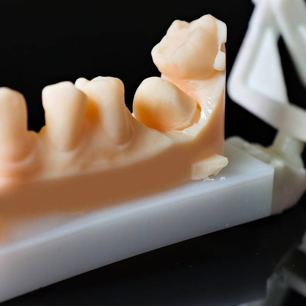 High - Strength Zirconia Dental Crown